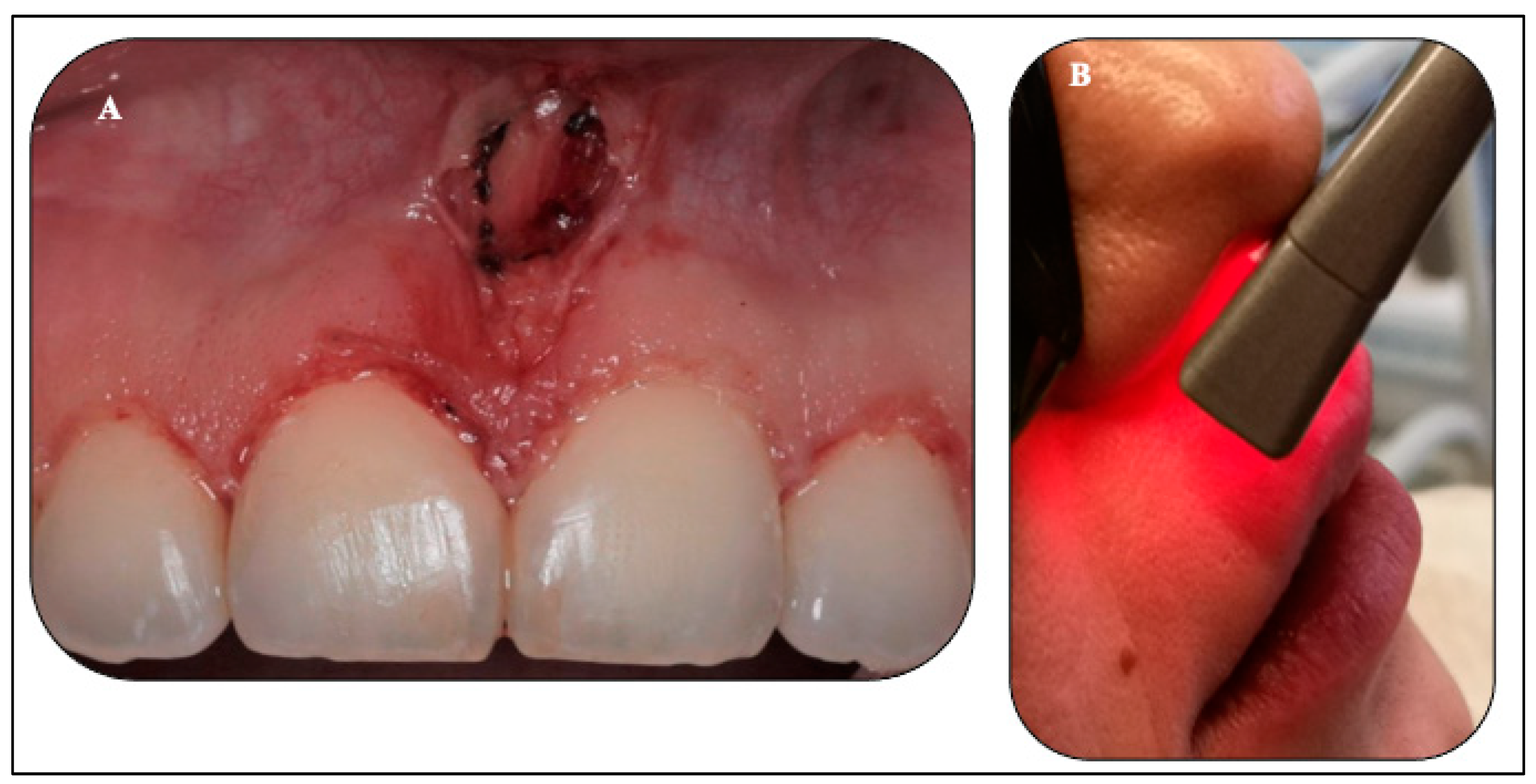 Sensors 22 02263 g007