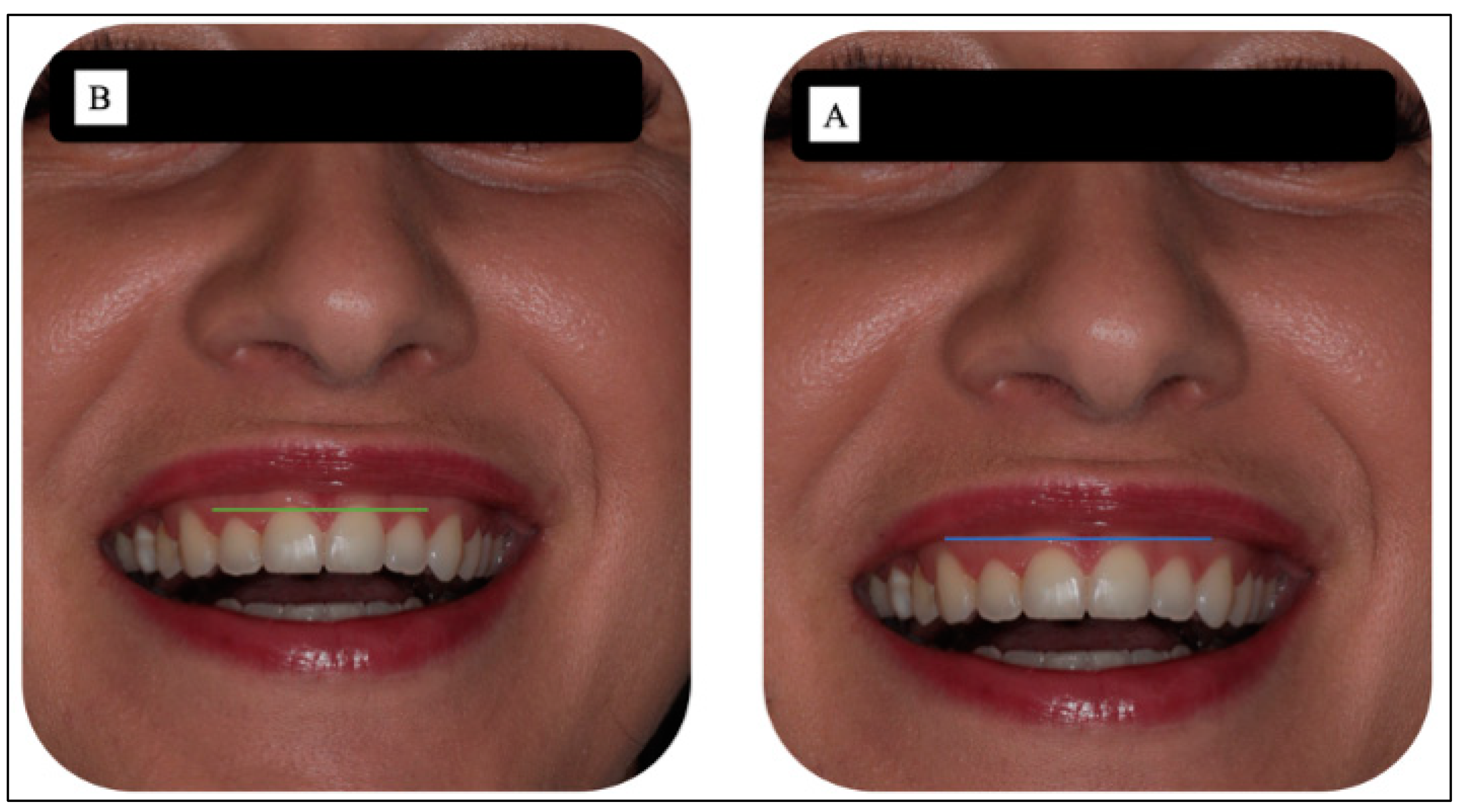 Sensors 22 02263 g010