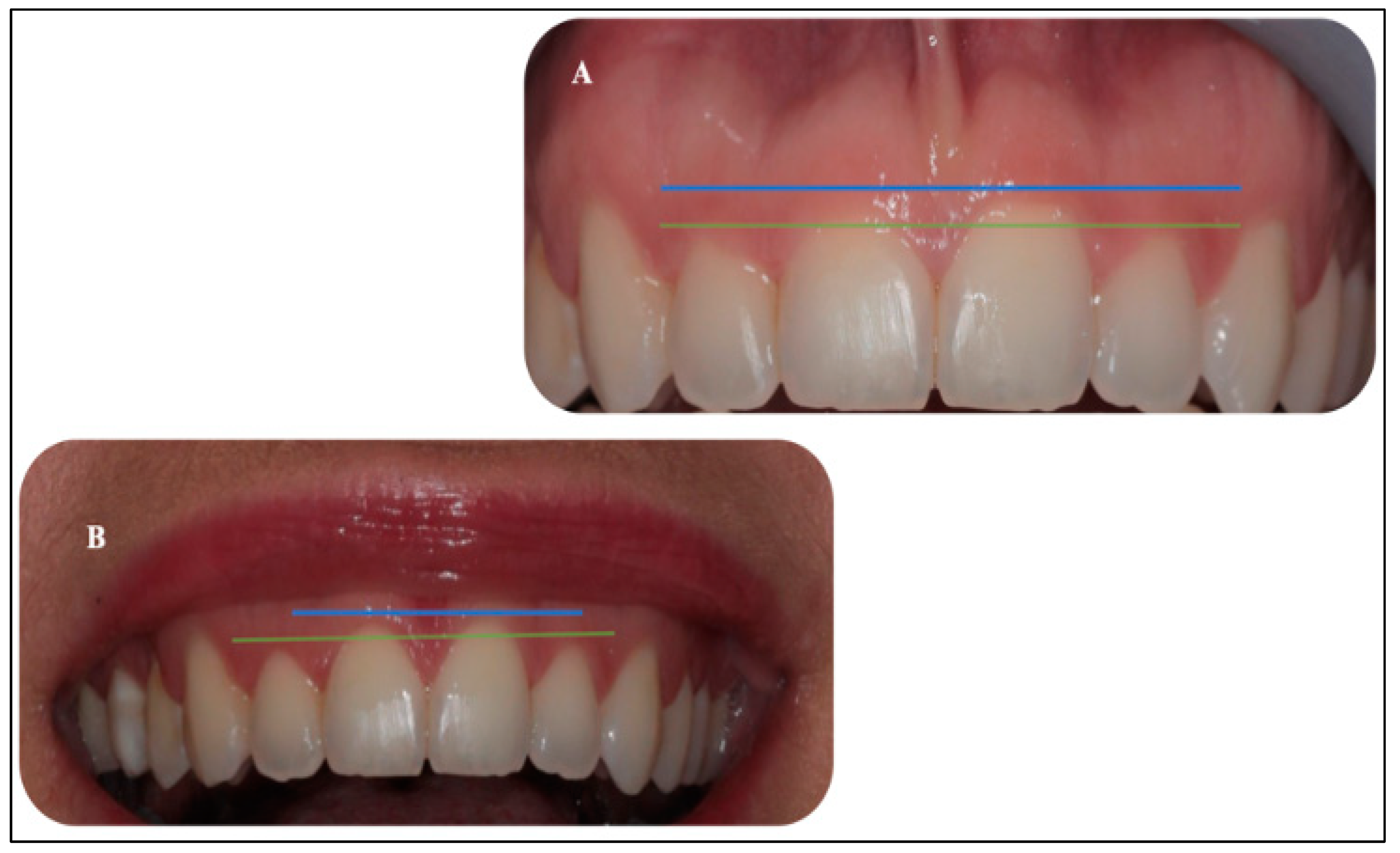 Sensors 22 02263 g011