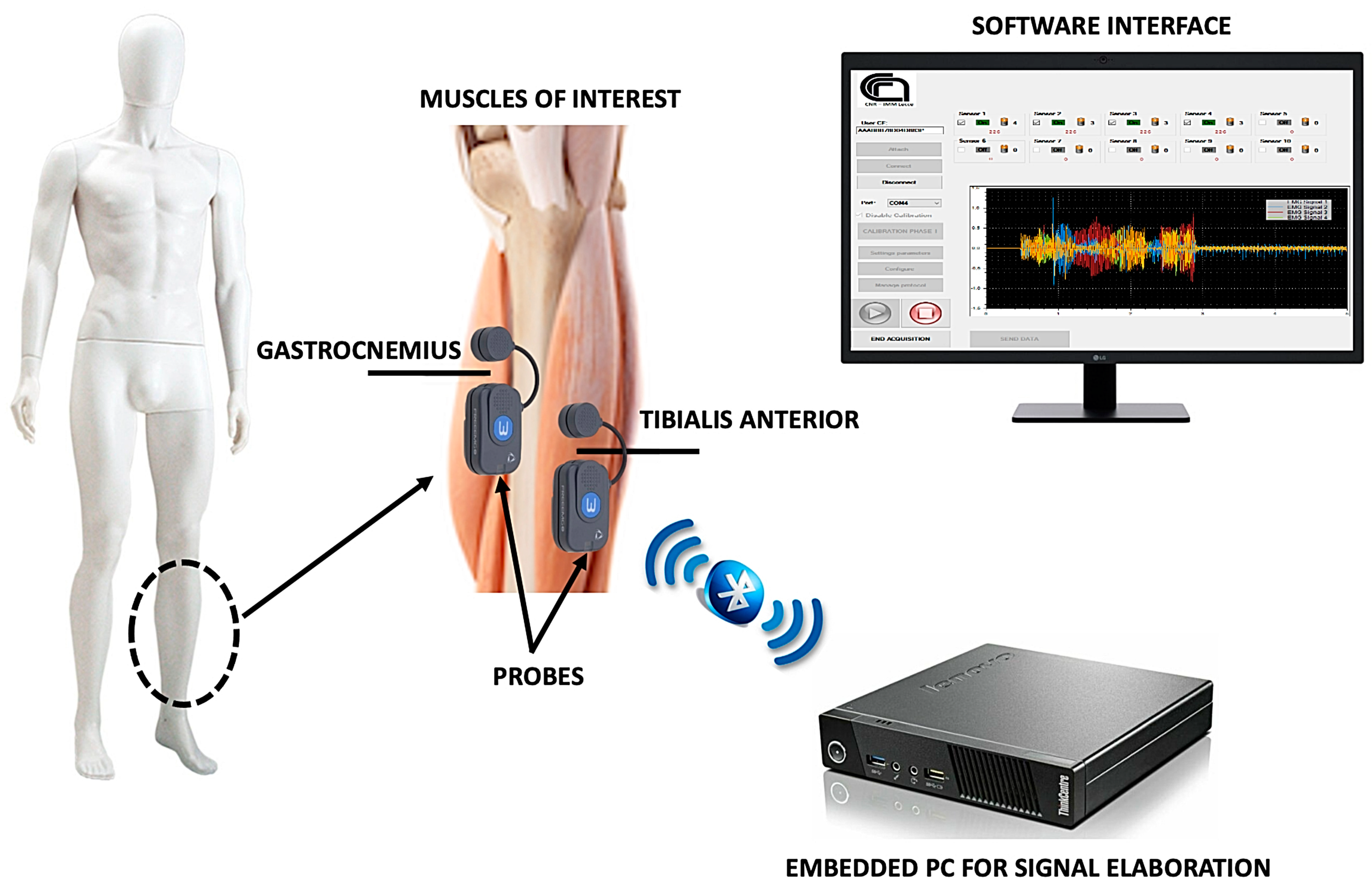 Sensors 22 02721 g001