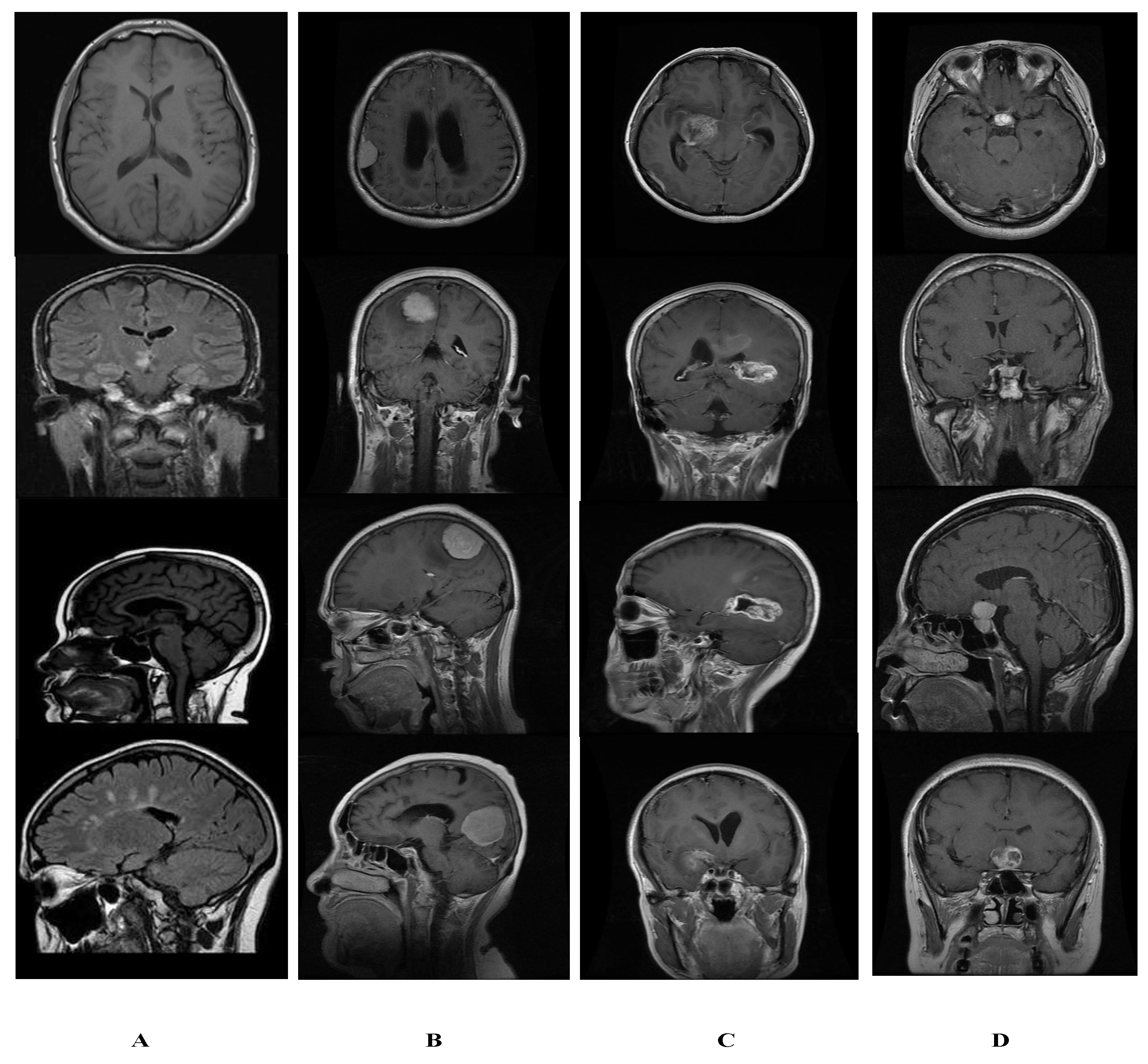 Sensors 22 02726 g005