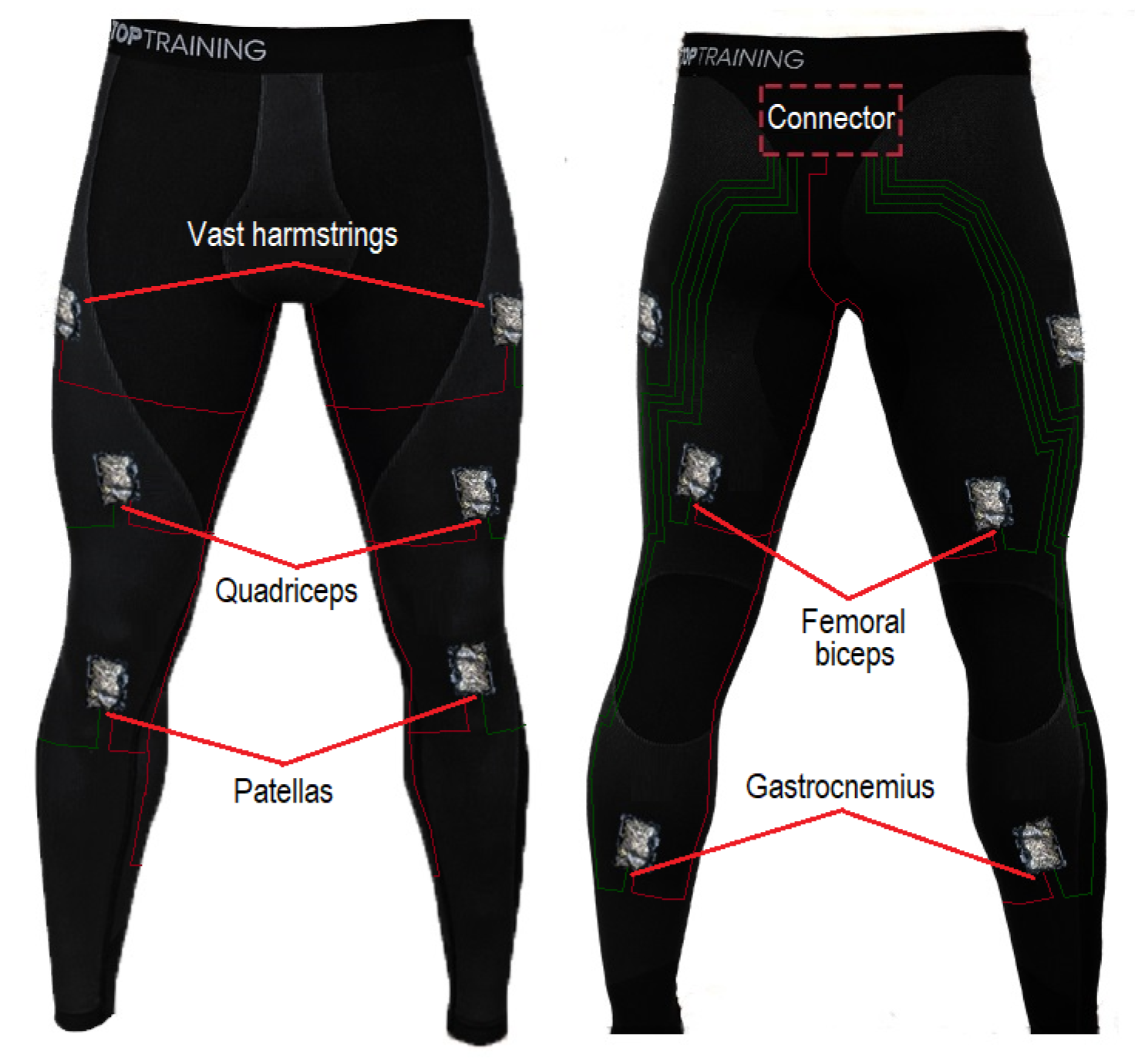 Sensors 22 02825 g002