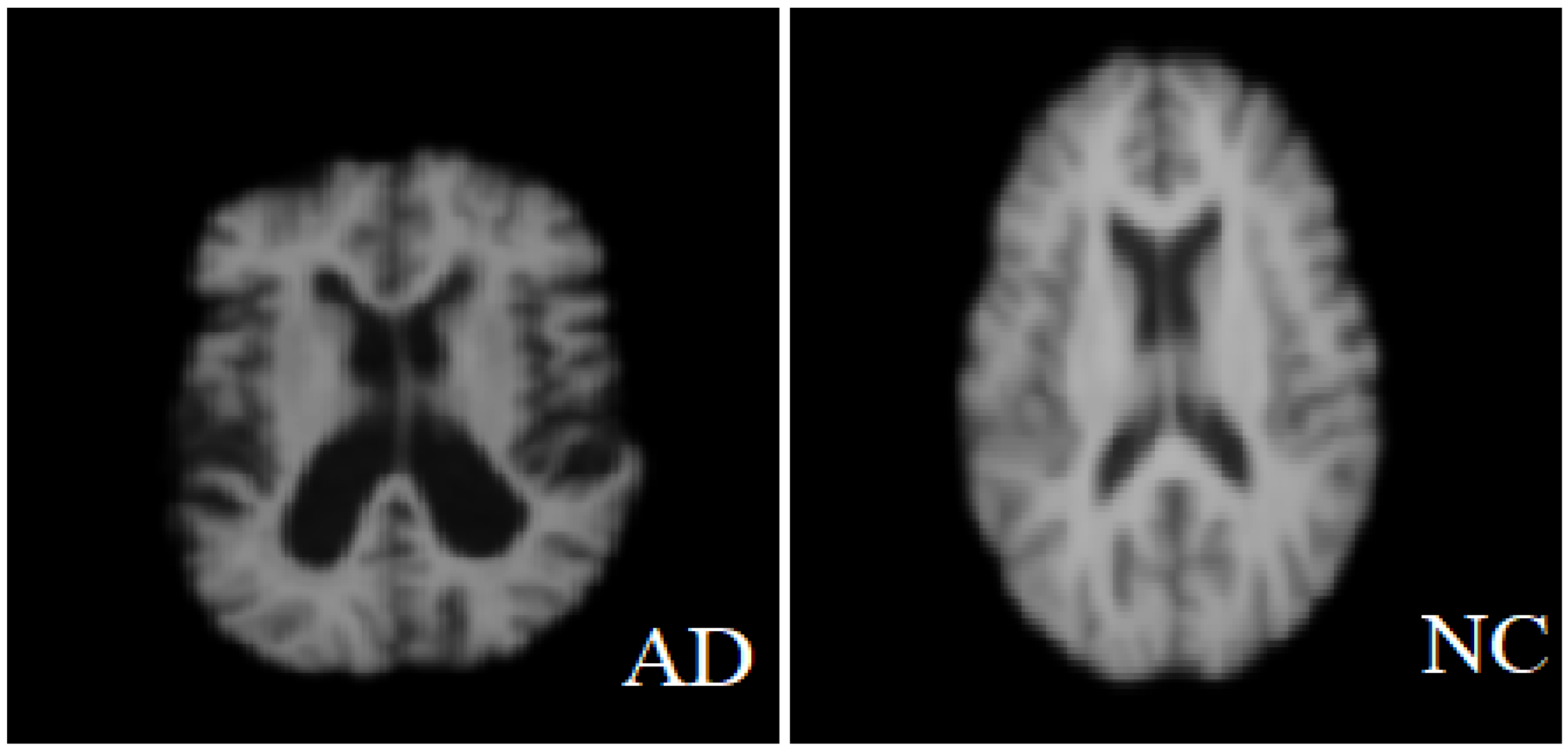 Sensors 22 02911 g004