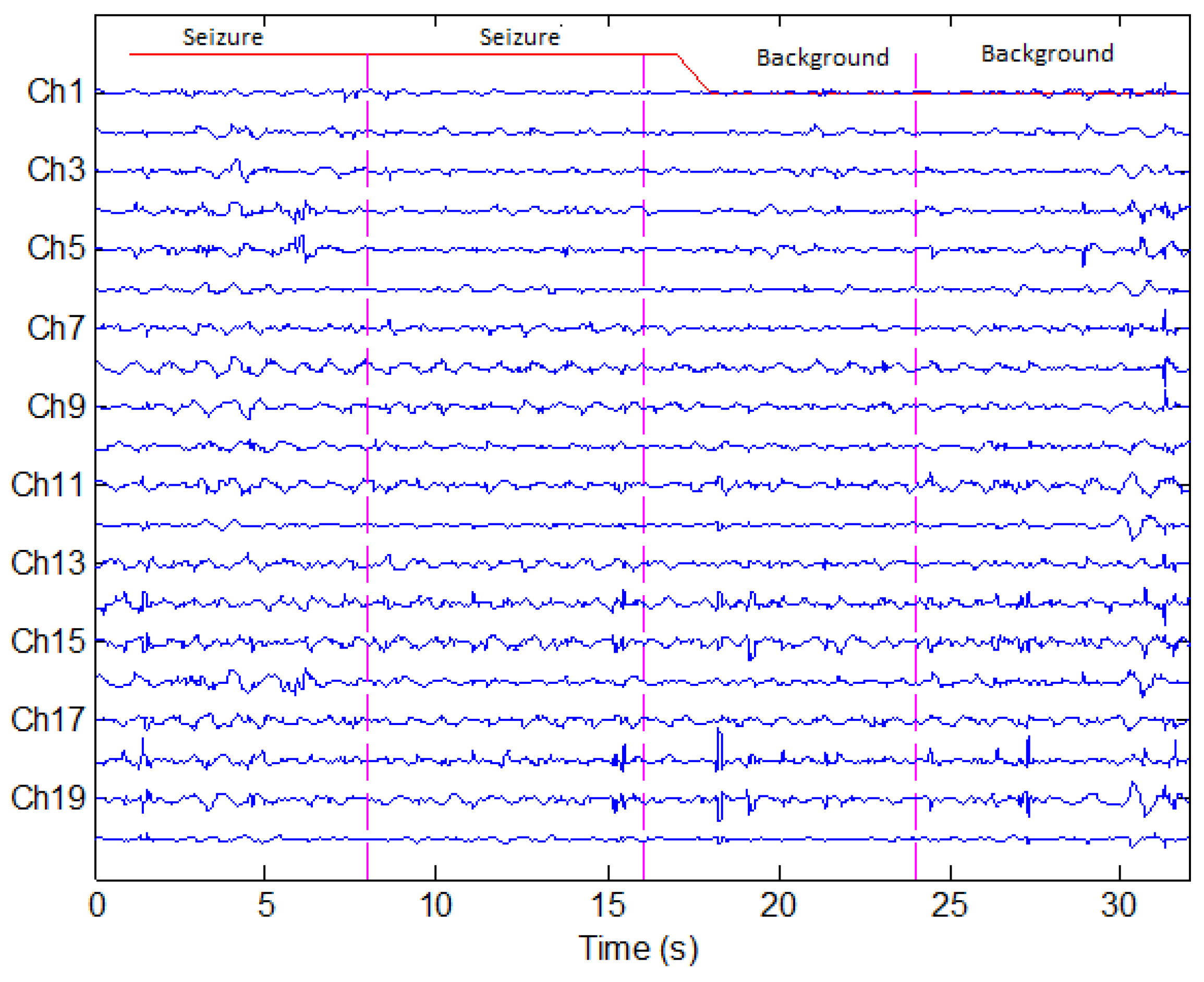 Sensors 22 03036 g006
