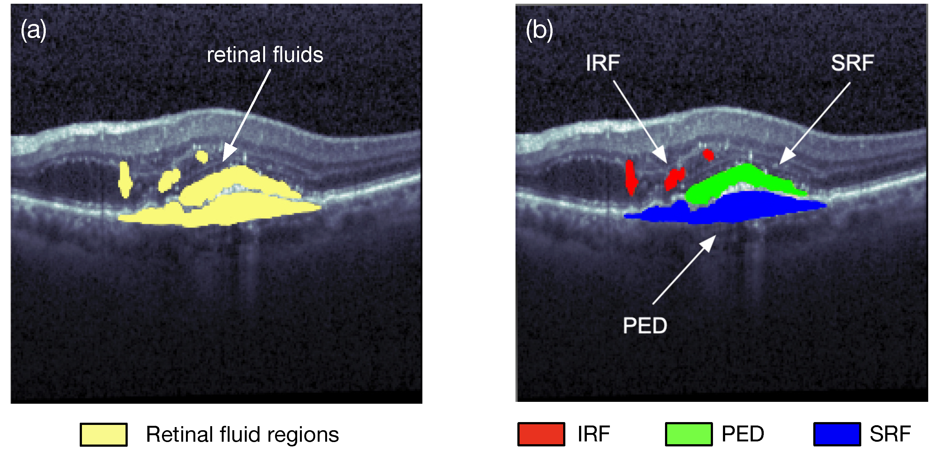 Sensors 22 03055 g003