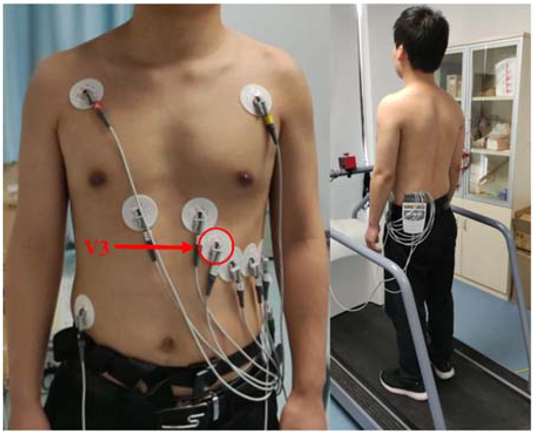 Sensors 22 03199 g001