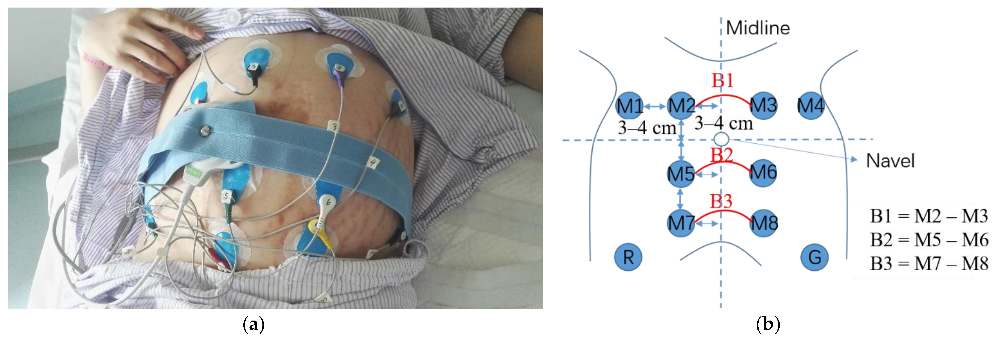 Sensors 22 03352 g002