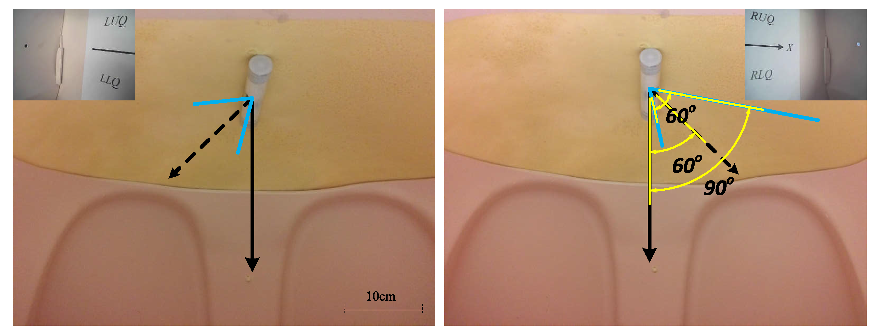 Sensors 22 03405 g016