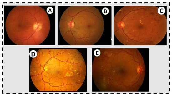 Sensors 22 03490 g001 550