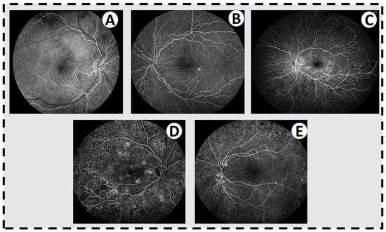 Sensors 22 03490 g002 550