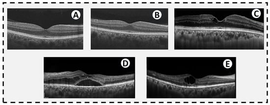 Sensors 22 03490 g003 550