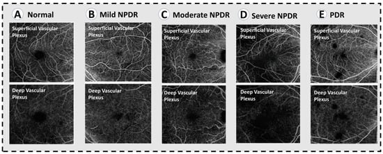 Sensors 22 03490 g004 550