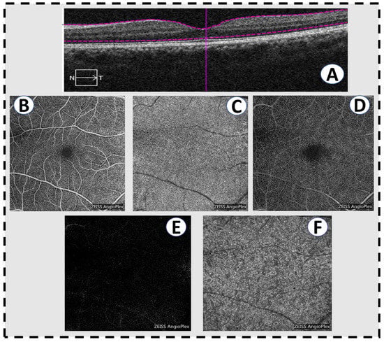 Sensors 22 03490 g005 550