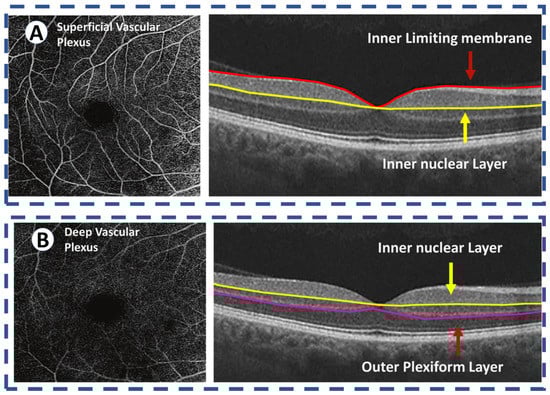 Sensors 22 03490 g006 550