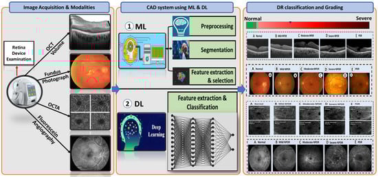 Sensors 22 03490 g007 550