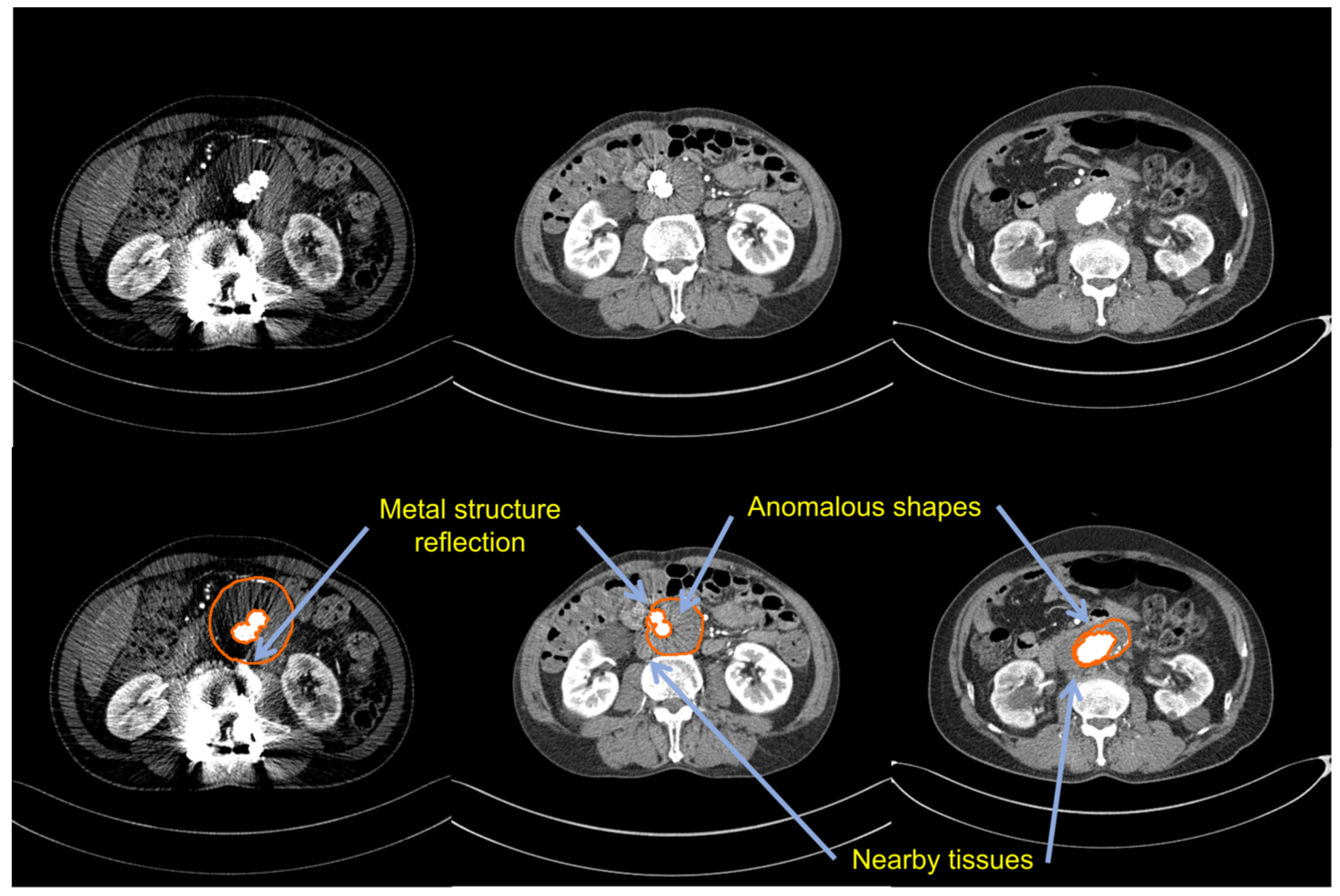 Sensors 22 03643 g001