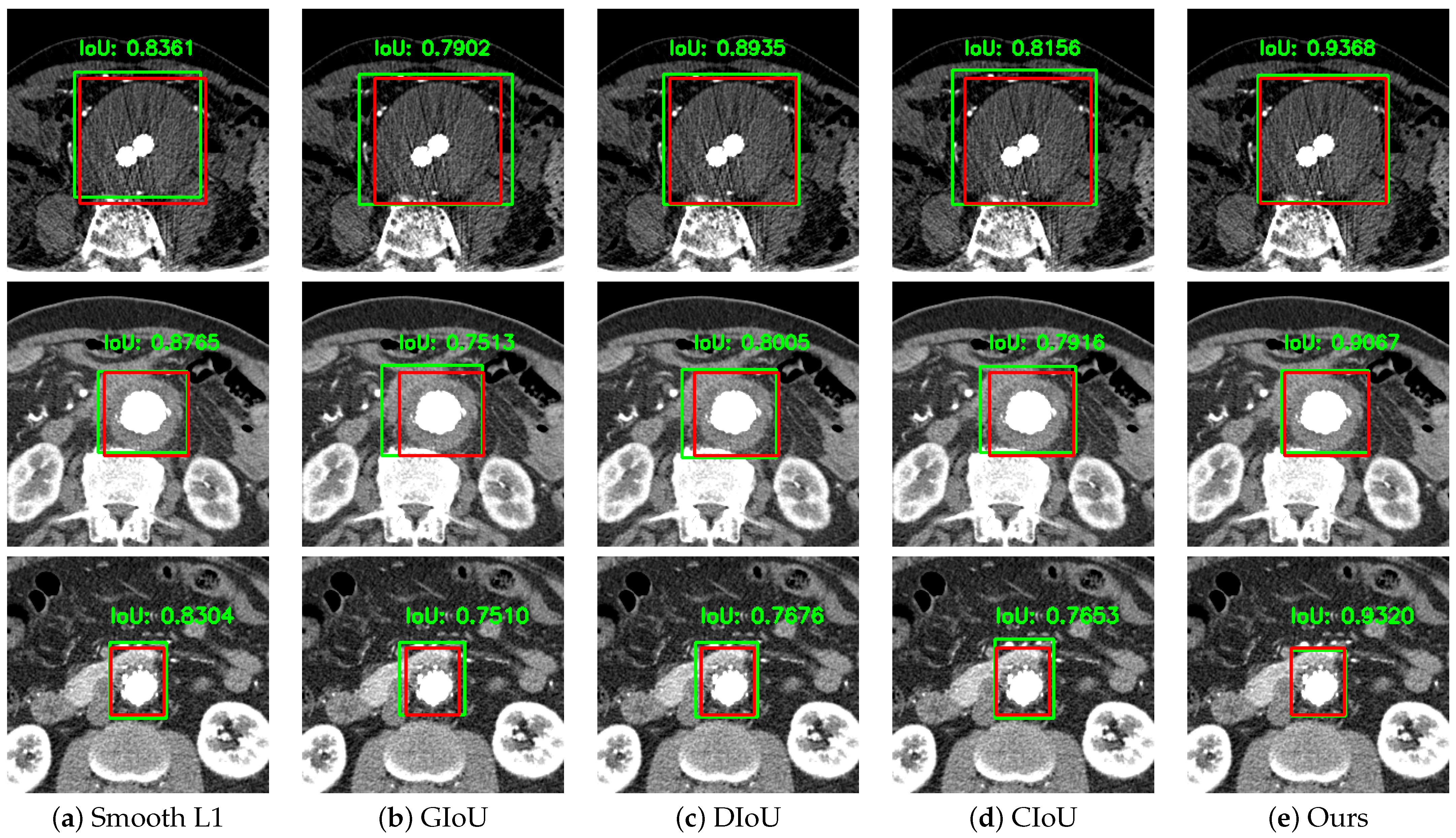 Sensors 22 03643 g004