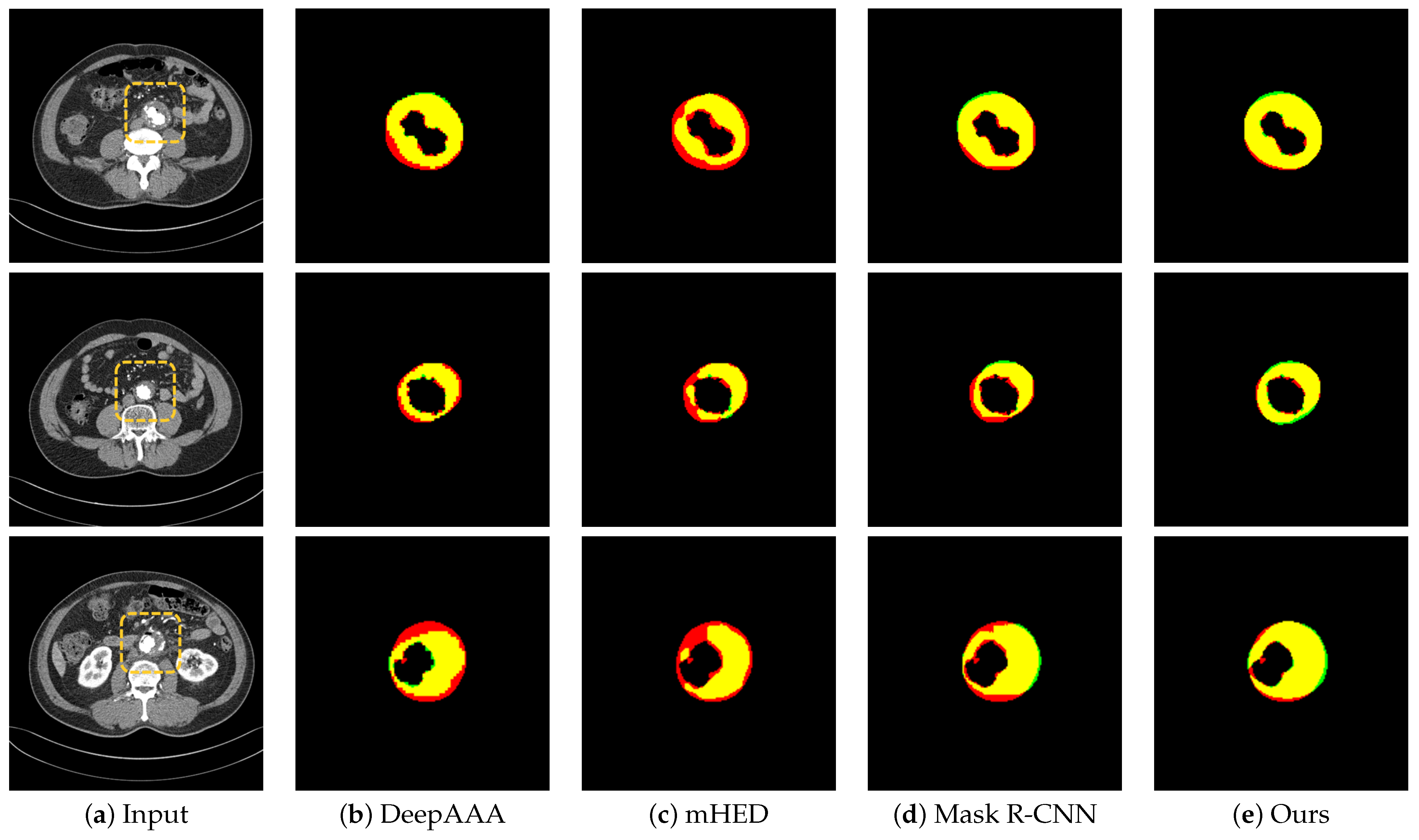 Sensors 22 03643 g005