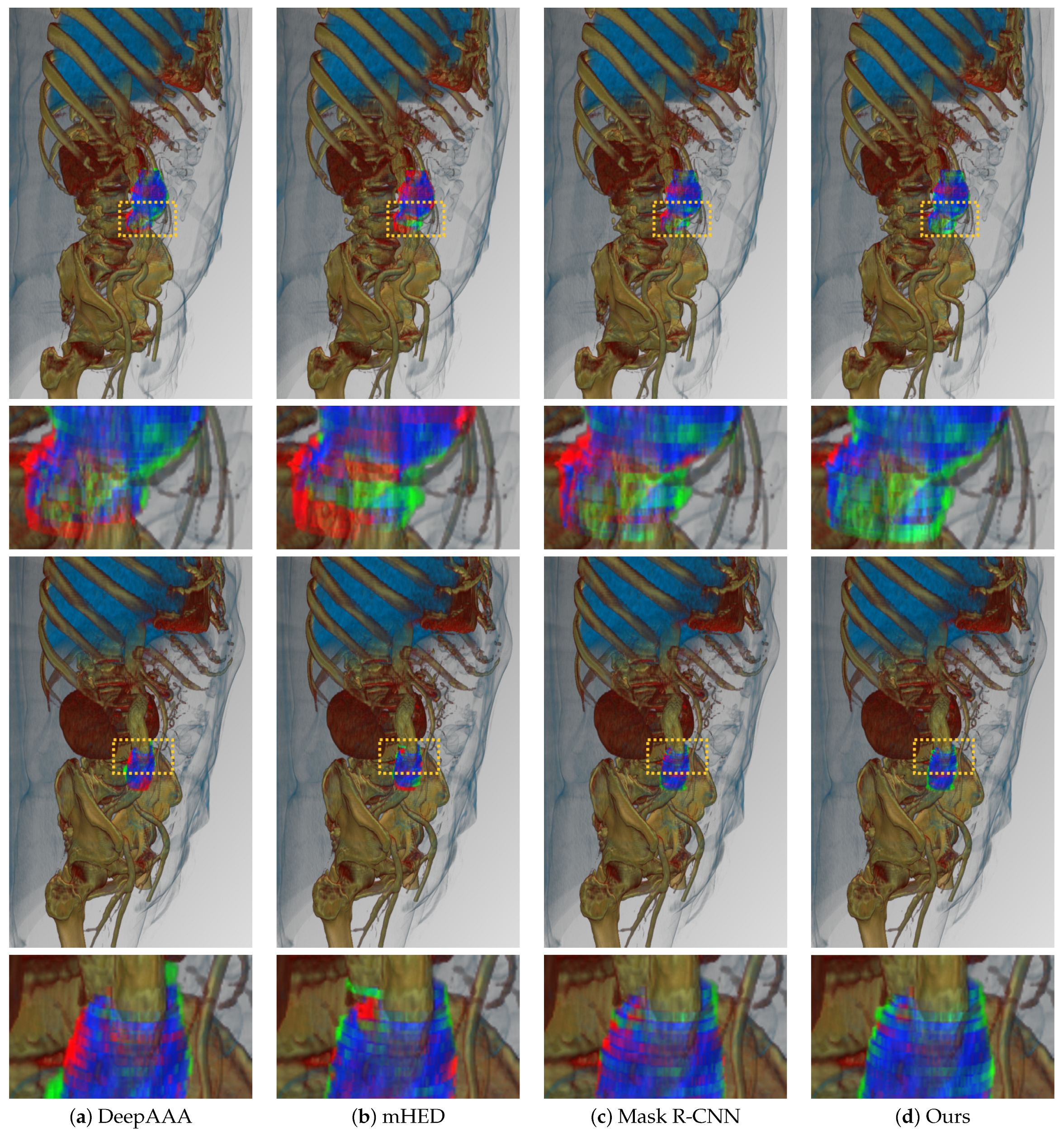 Sensors 22 03643 g006