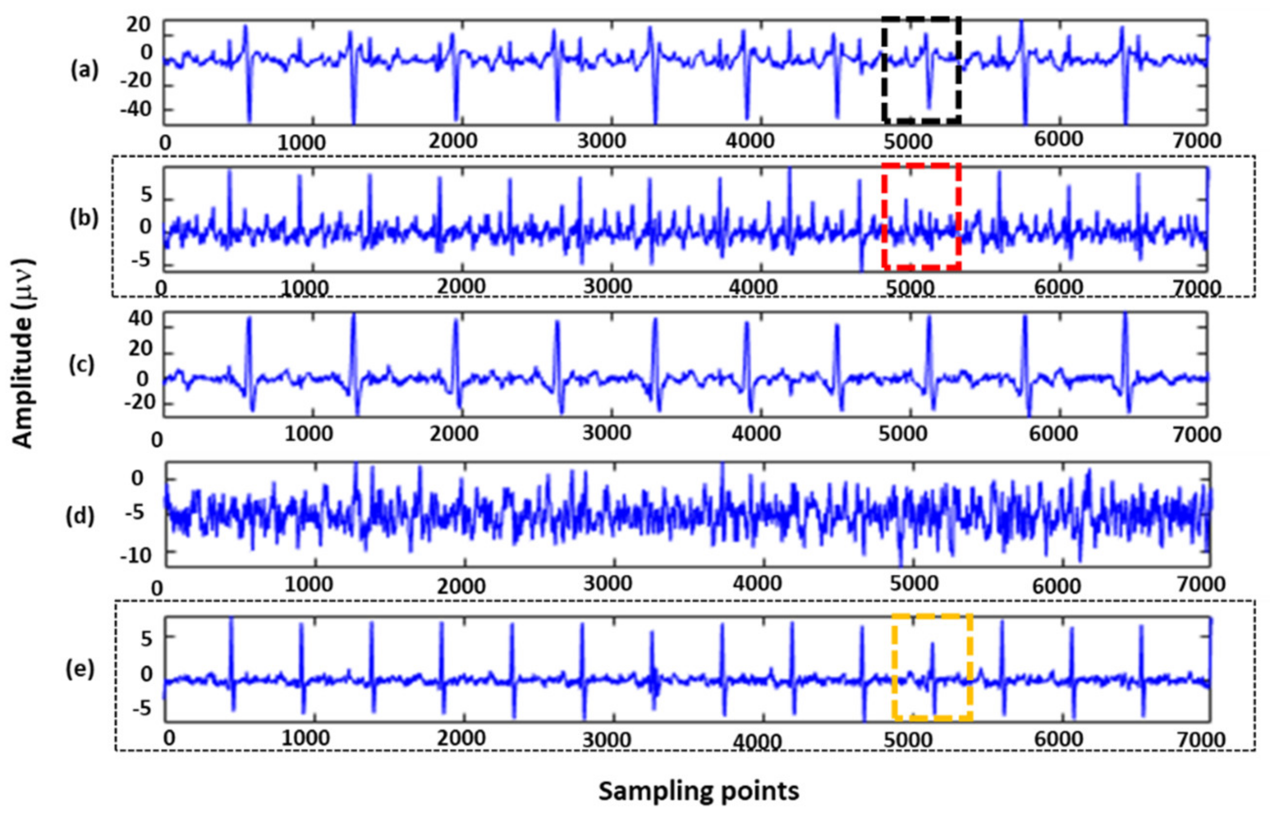 Sensors 22 03705 g003