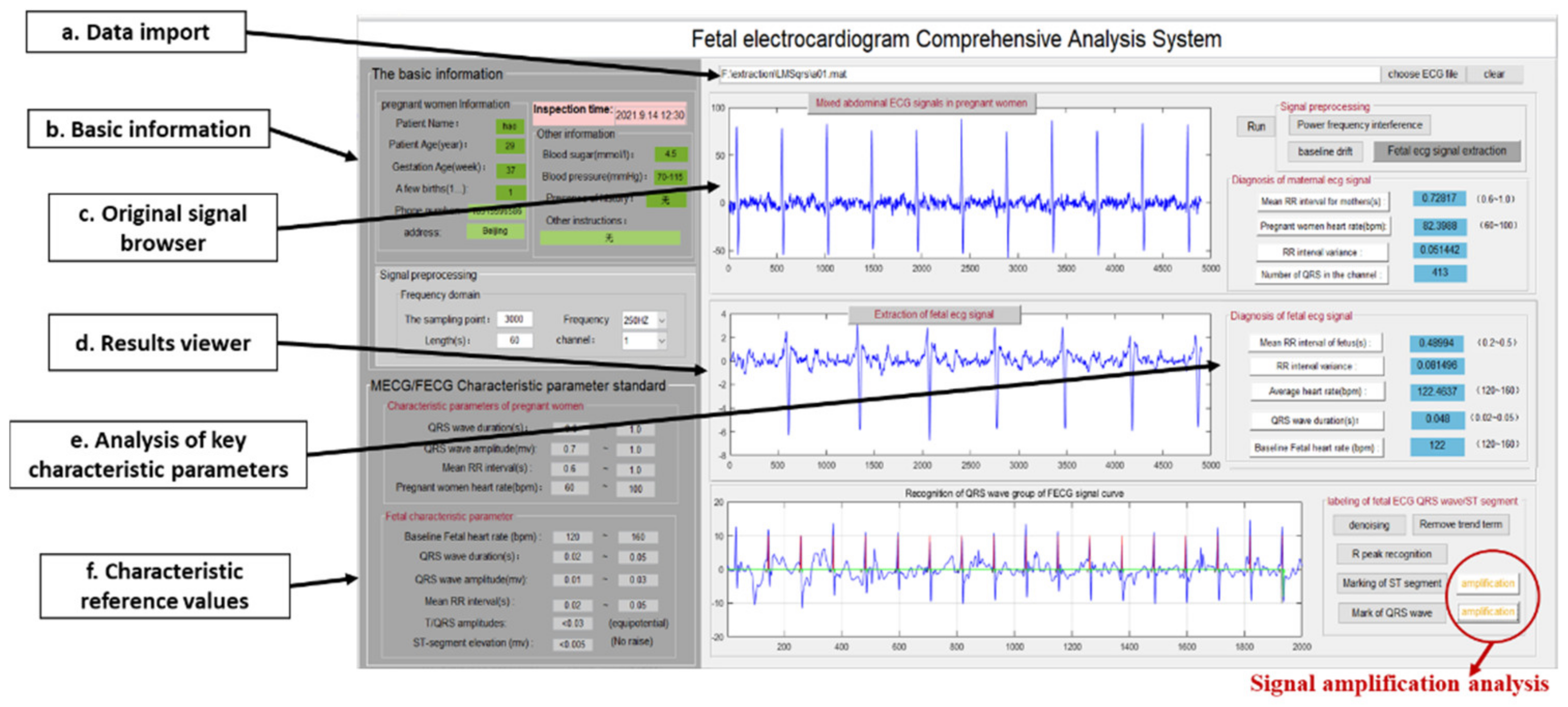 Sensors 22 03705 g006
