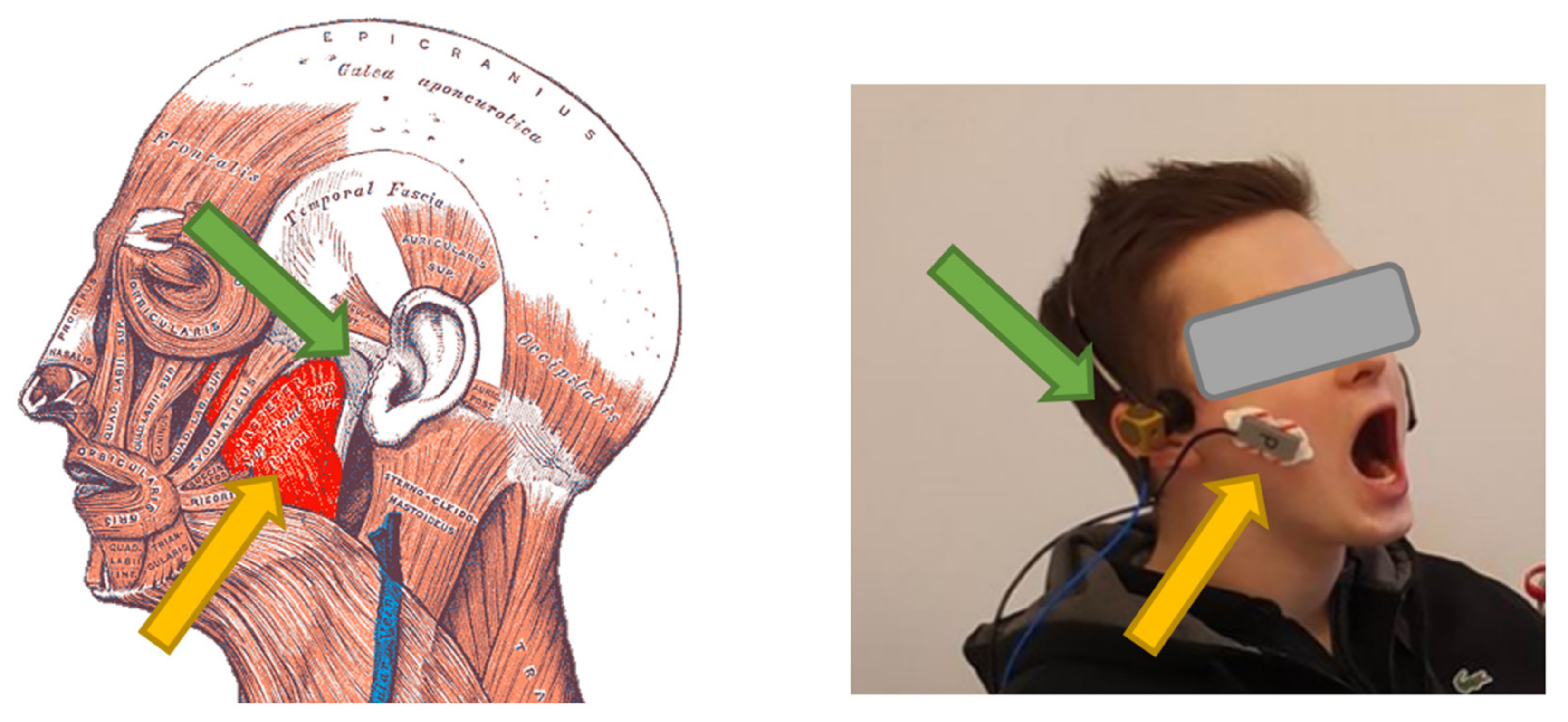 Sensors 22 03811 g003