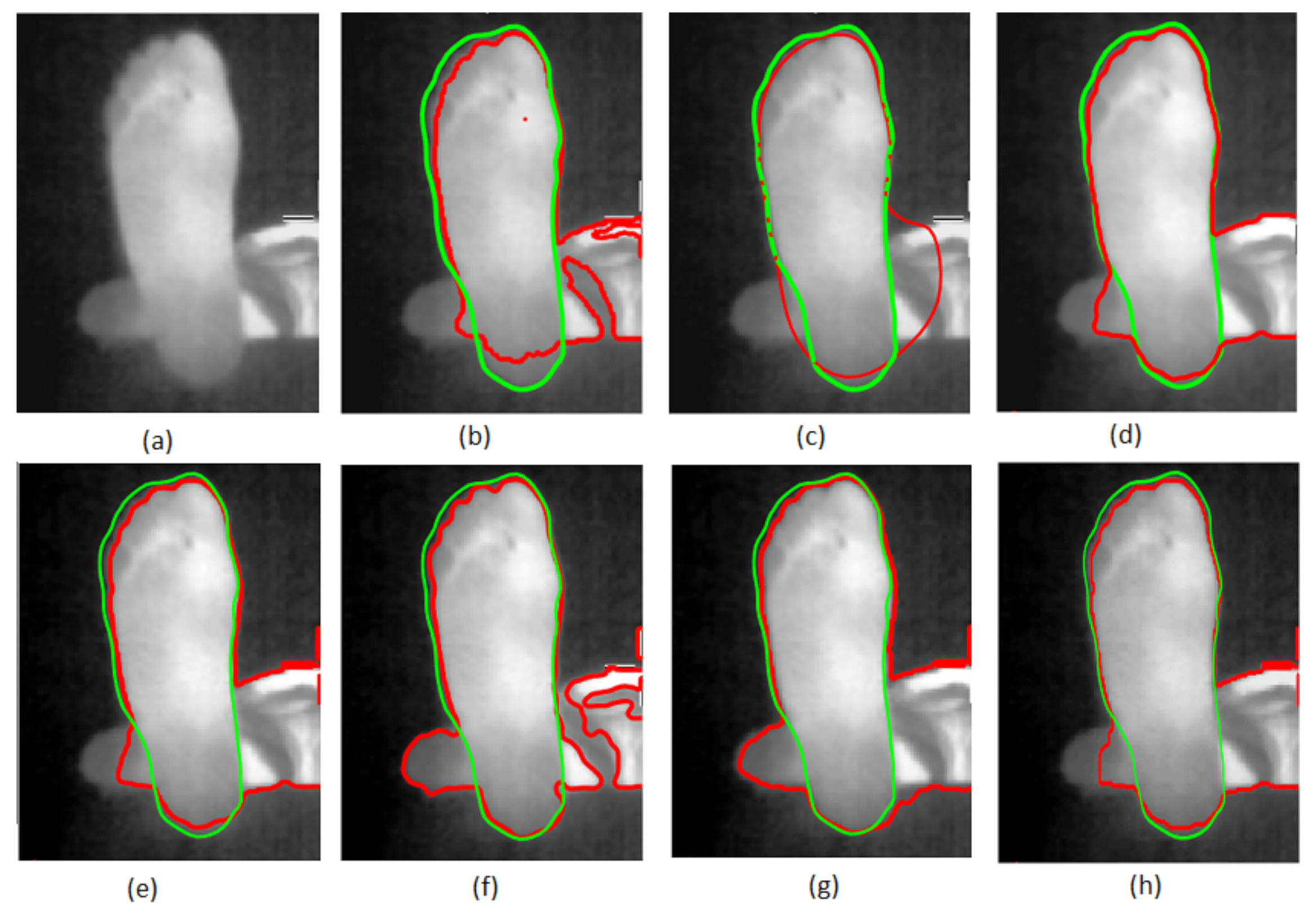 Sensors 22 03835 g004