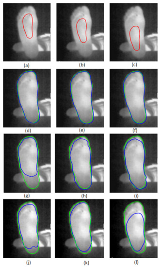 Sensors 22 03835 g007 550