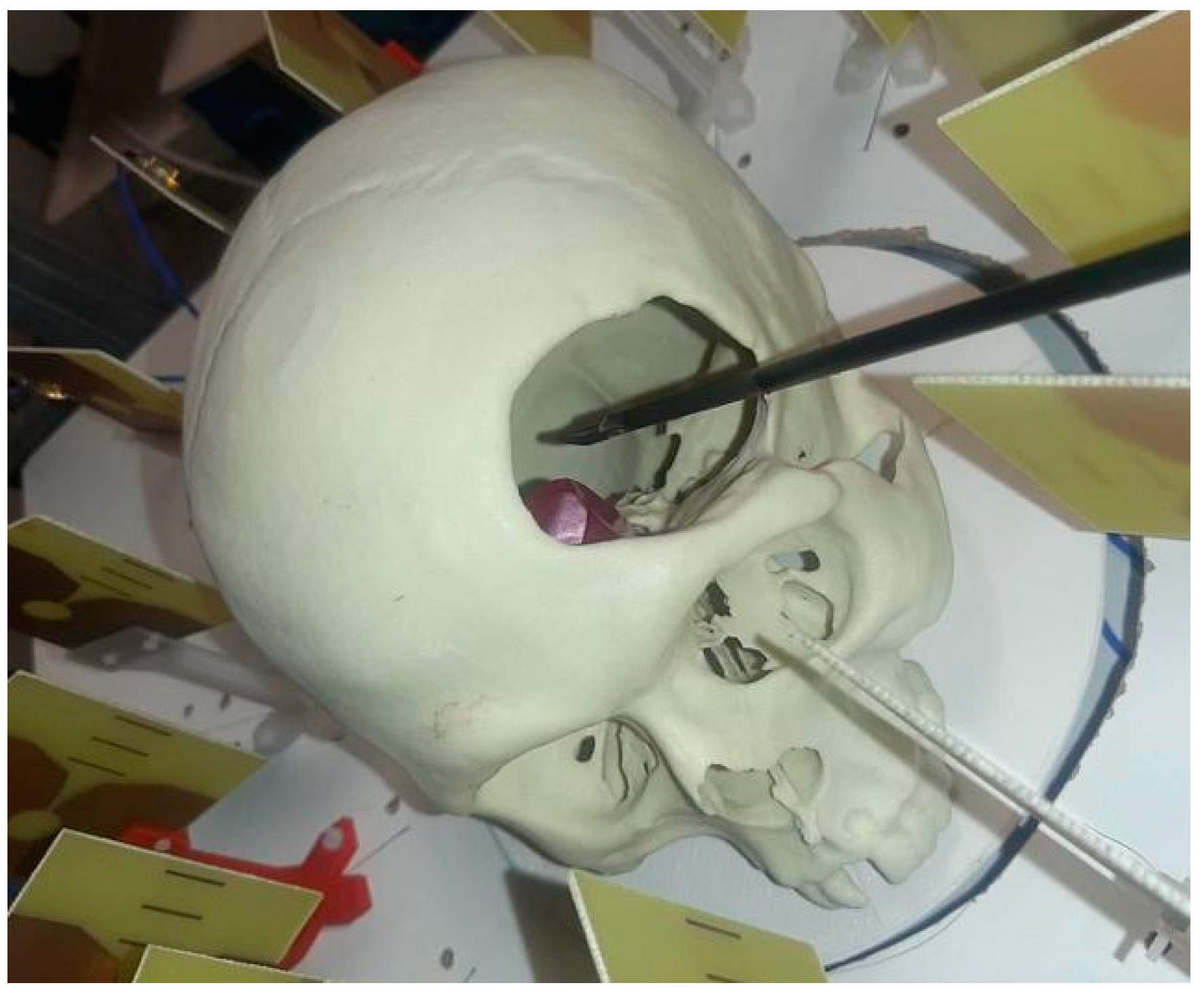 Sensors 22 03845 g017