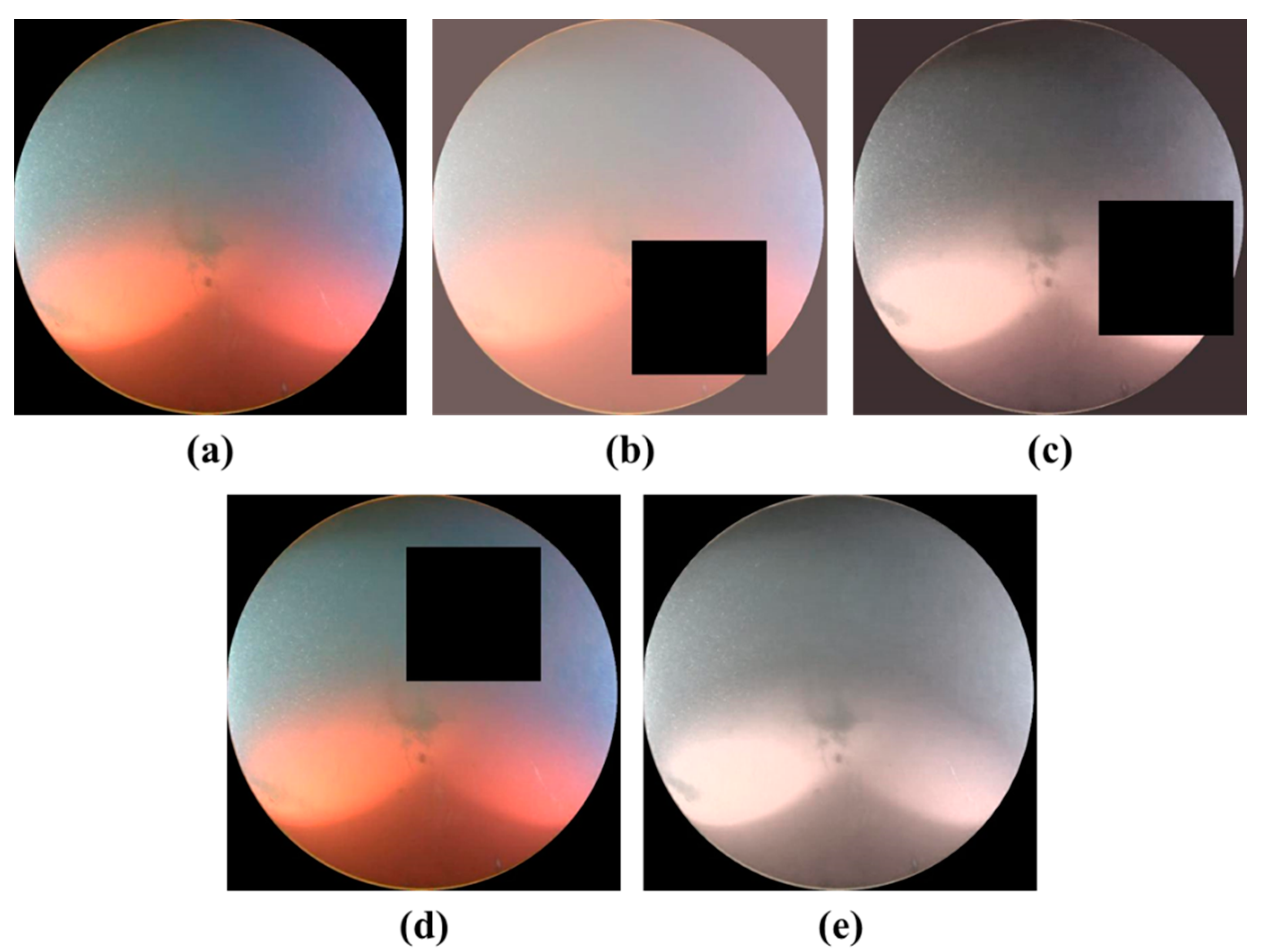 Sensors 22 04392 g005