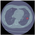 Sensors 22 04426 i001