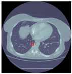 Sensors 22 04426 i002