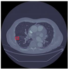 Sensors 22 04426 i003