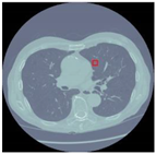 Sensors 22 04426 i004