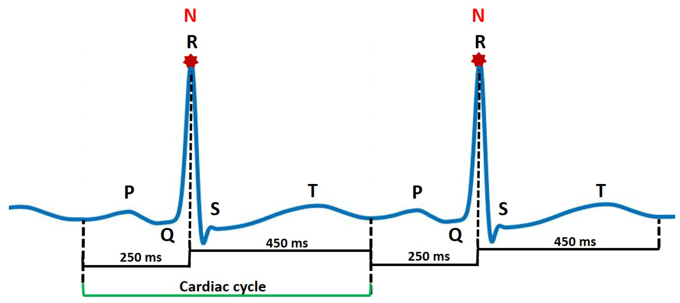 Sensors 22 04450 g005