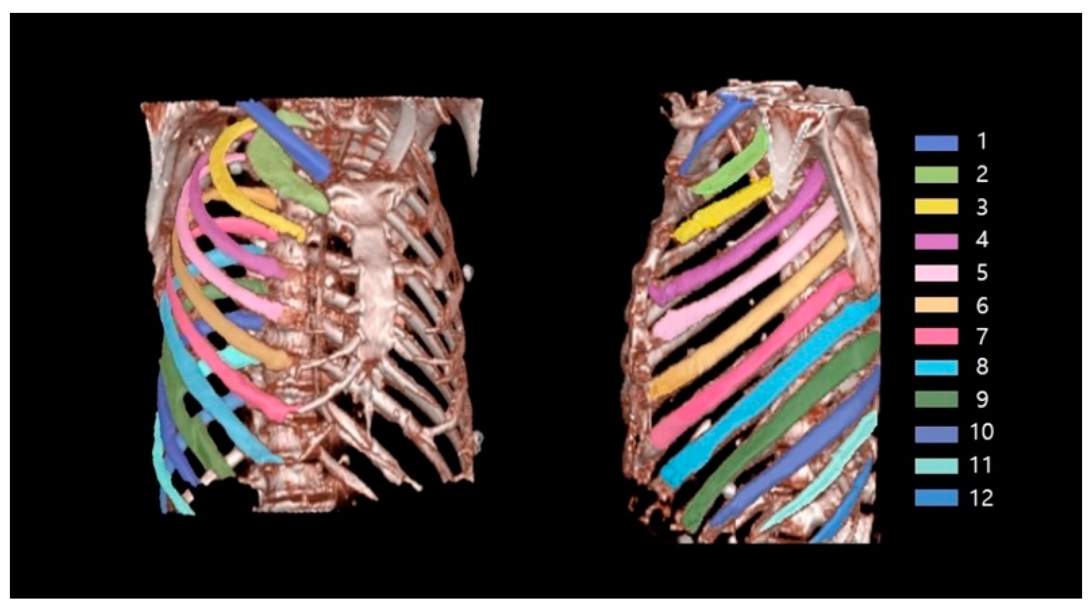 Sensors 22 04530 g006