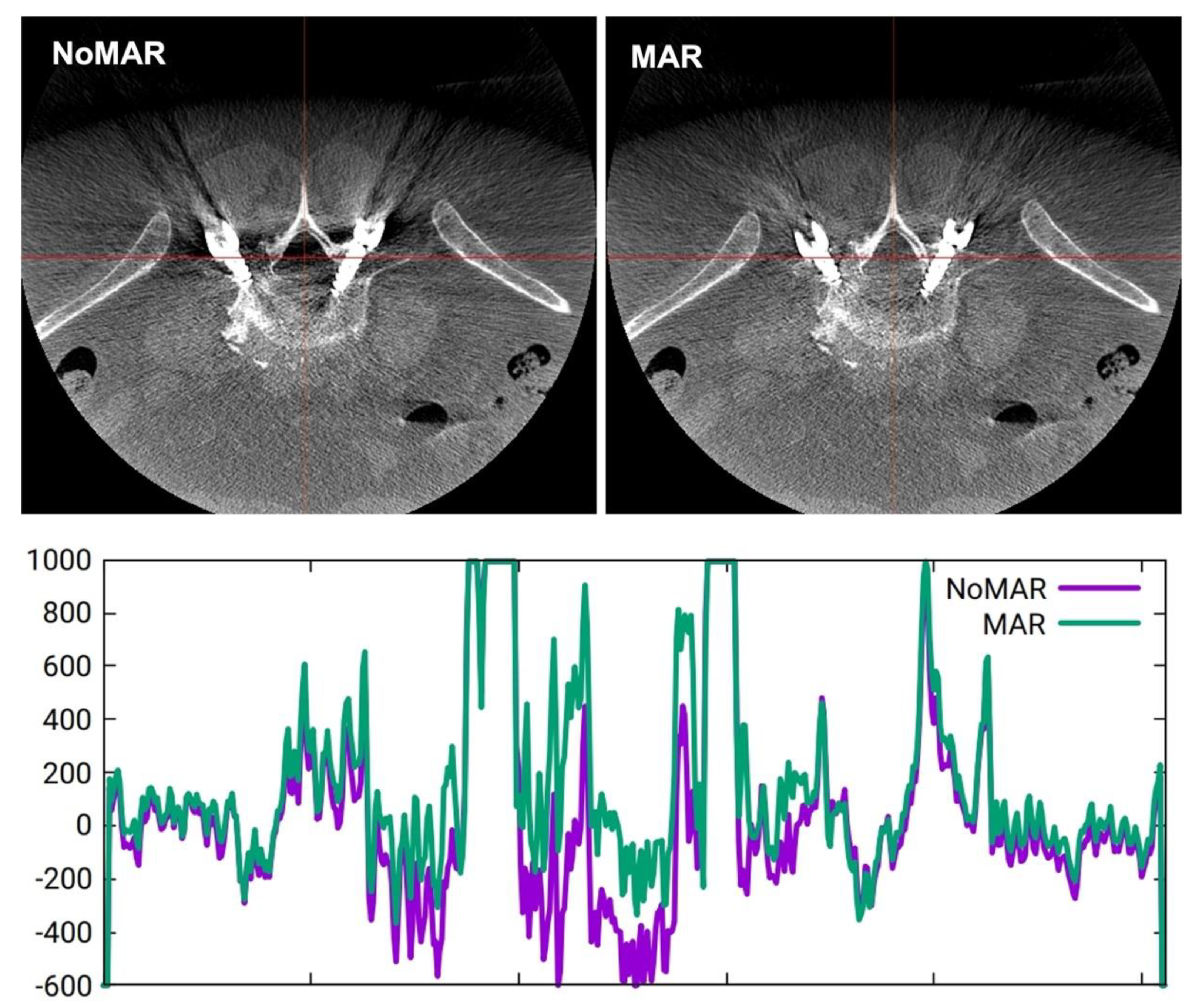 Sensors 22 04615 g002
