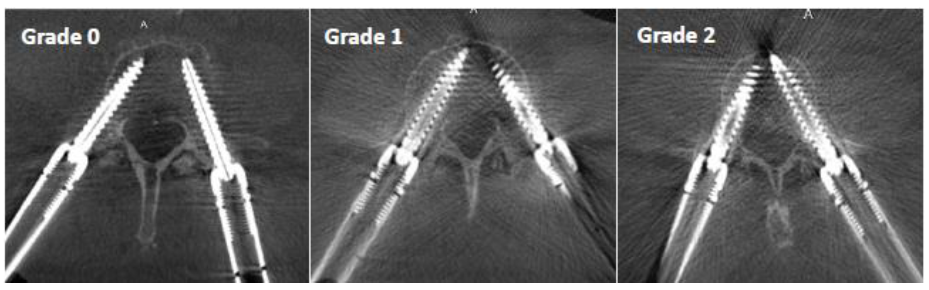 Sensors 22 04615 g004