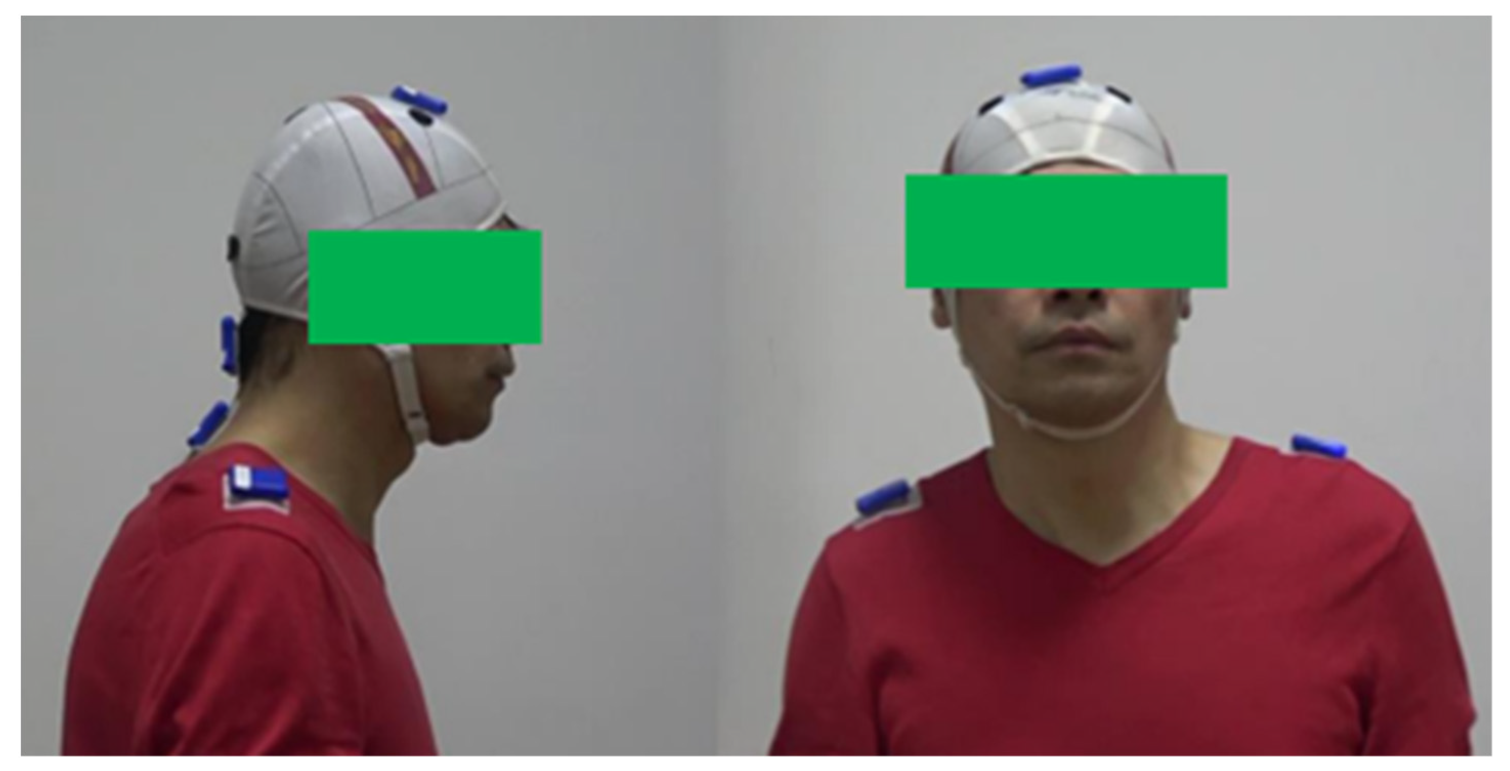 Sensors 22 04642 g002