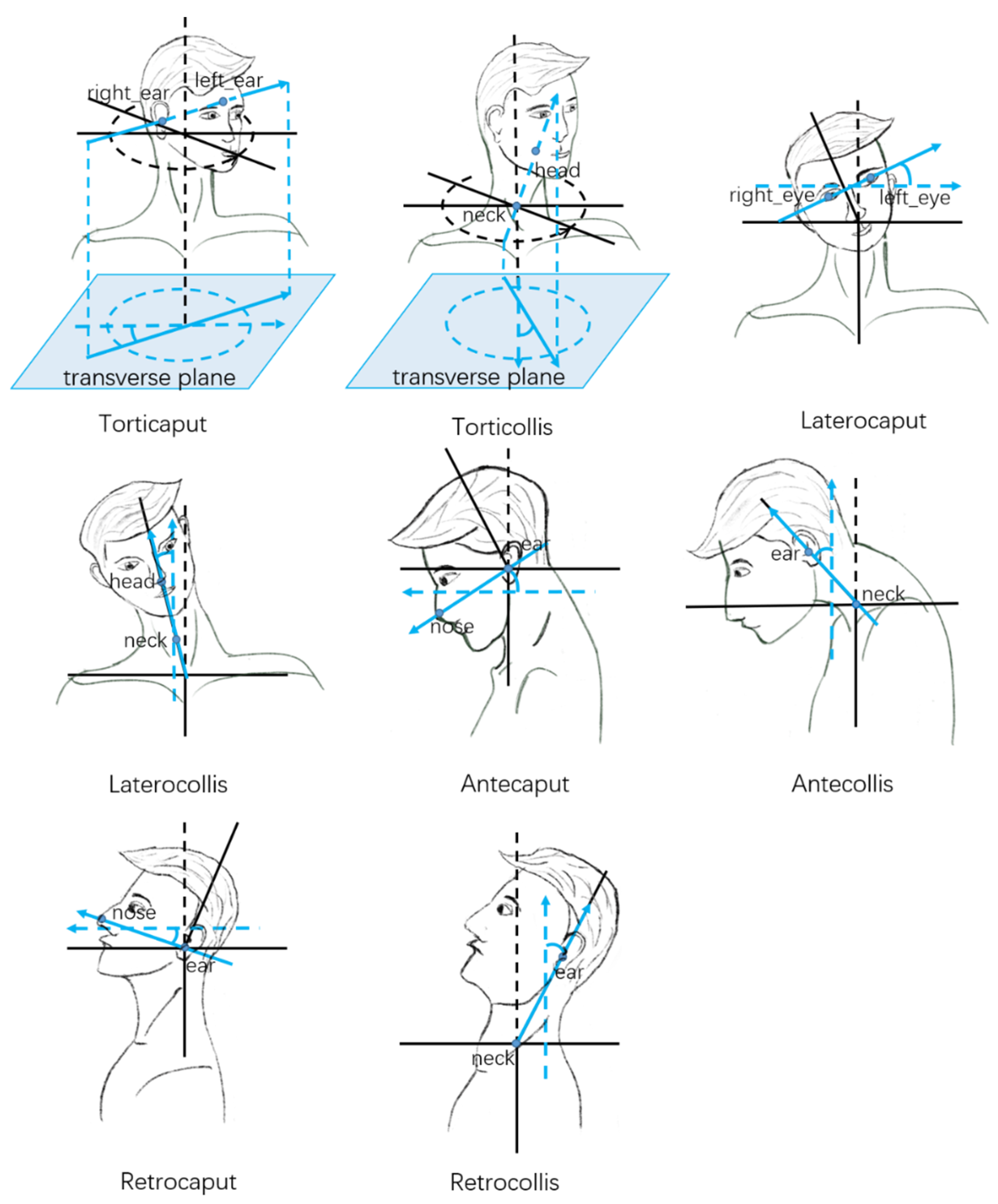Sensors 22 04642 g006