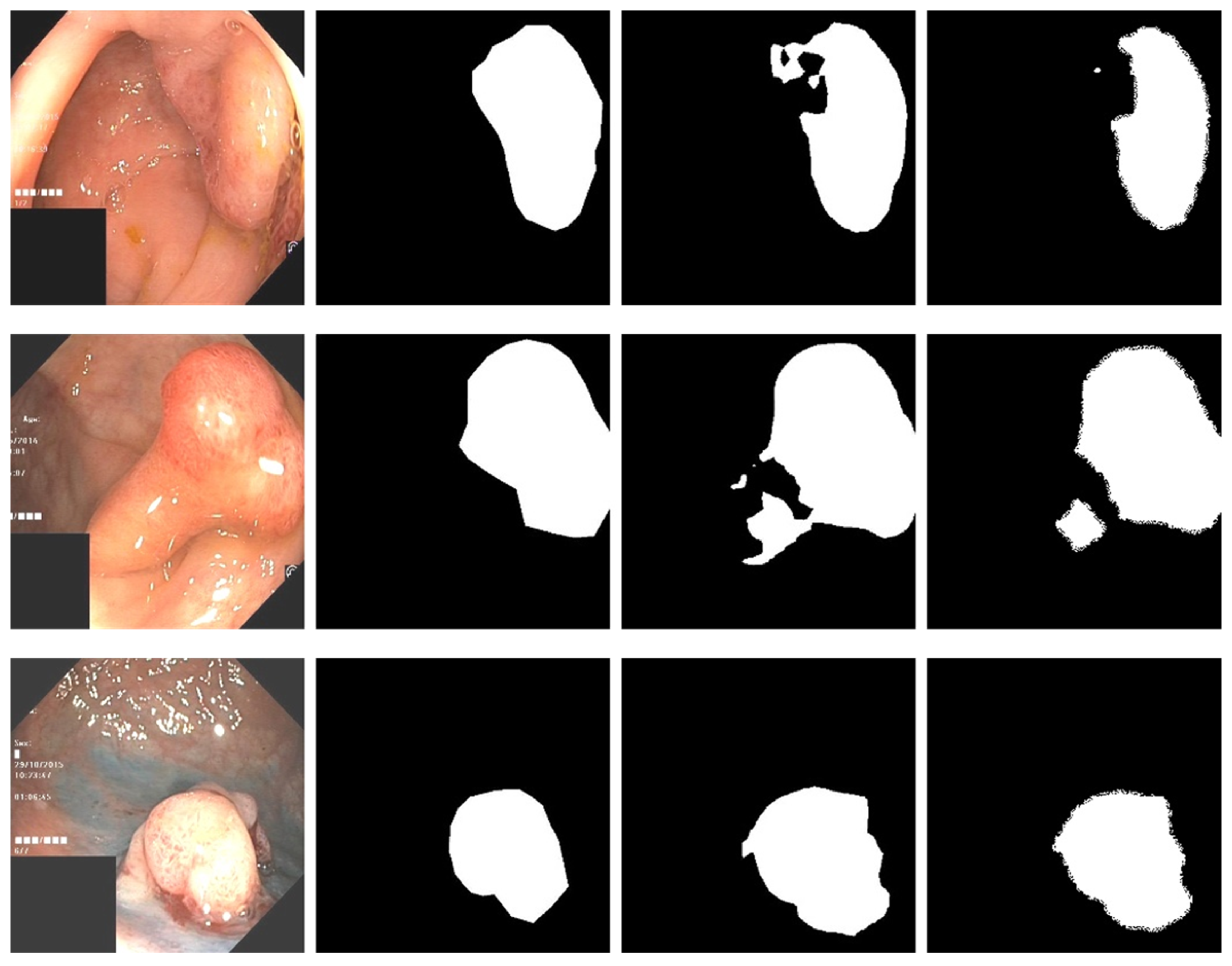 Sensors 22 04658 g005