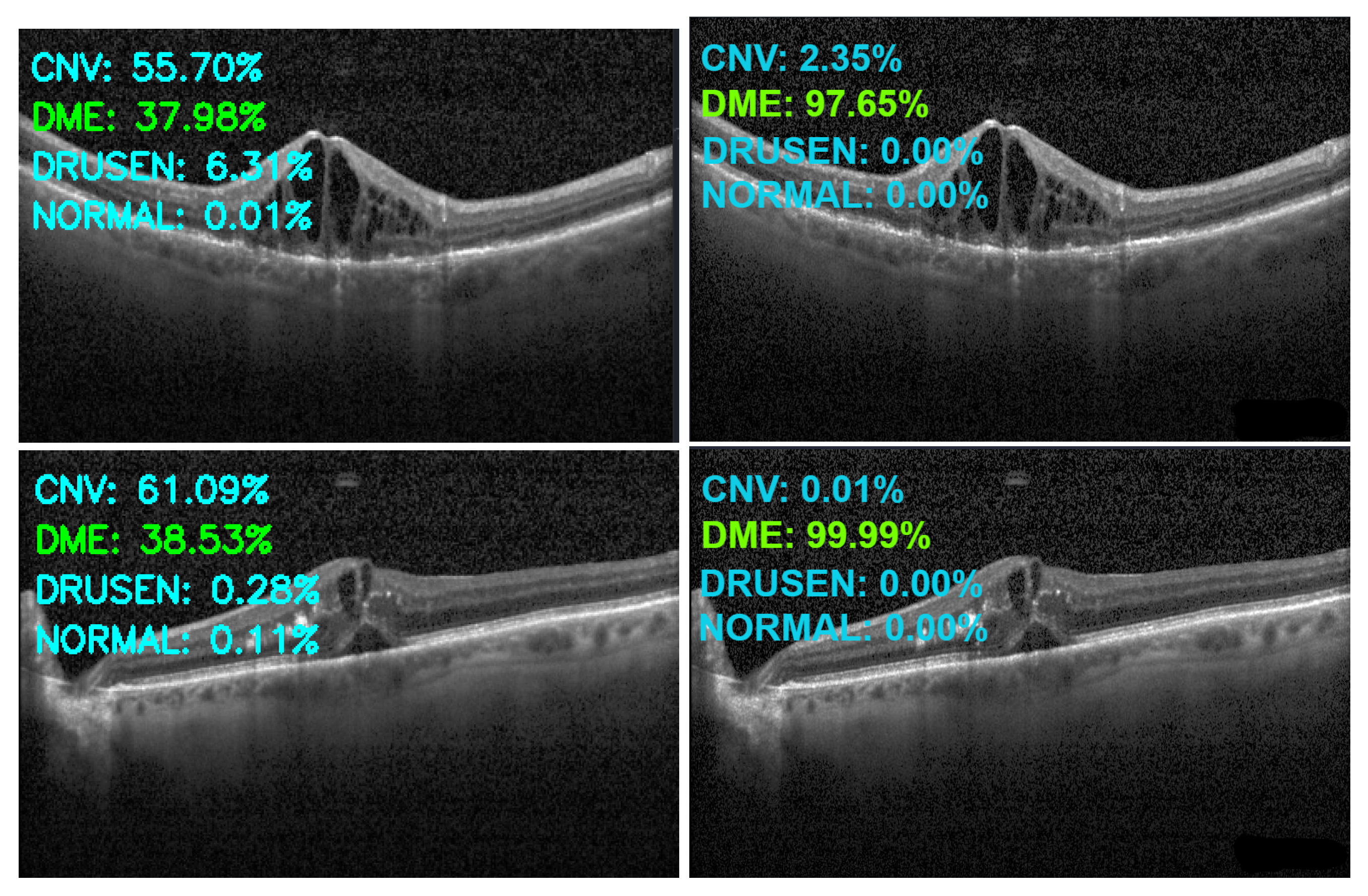 Sensors 22 04675 g014