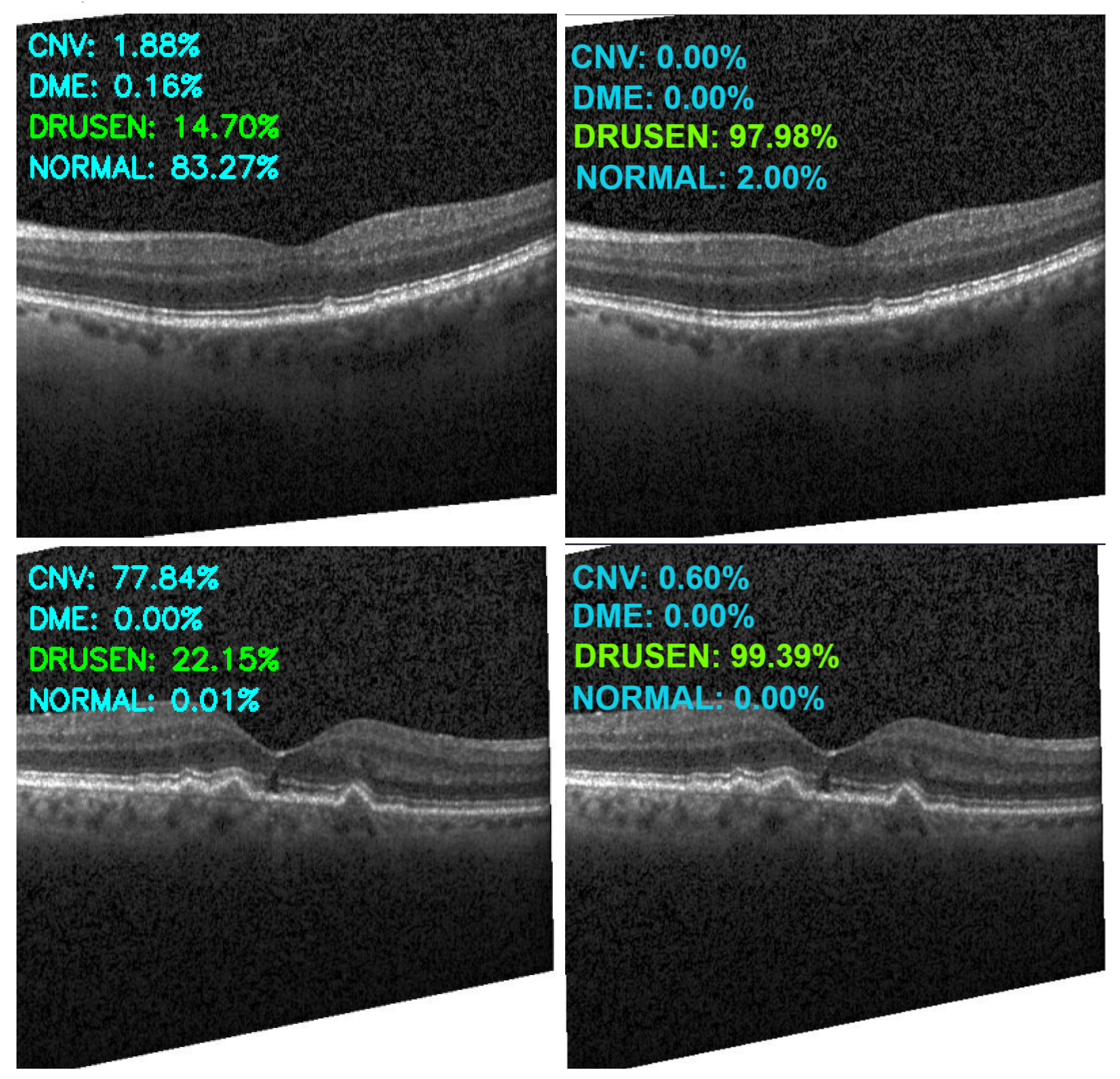 Sensors 22 04675 g015