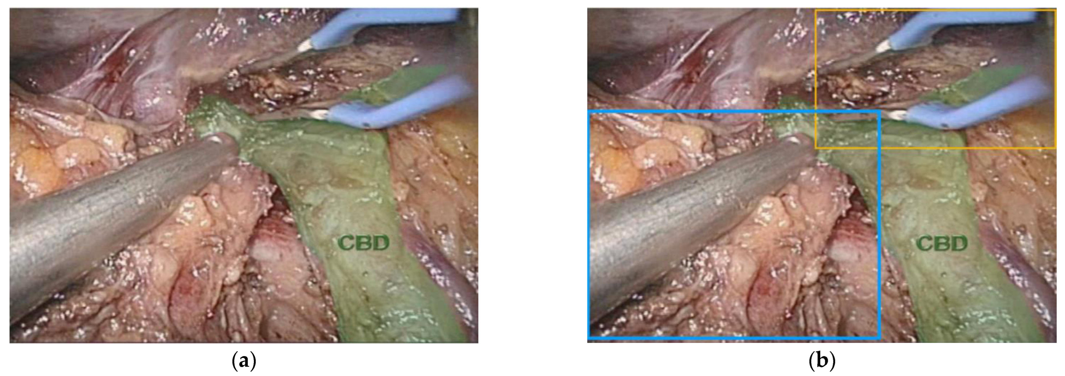 Sensors 22 04918 g004