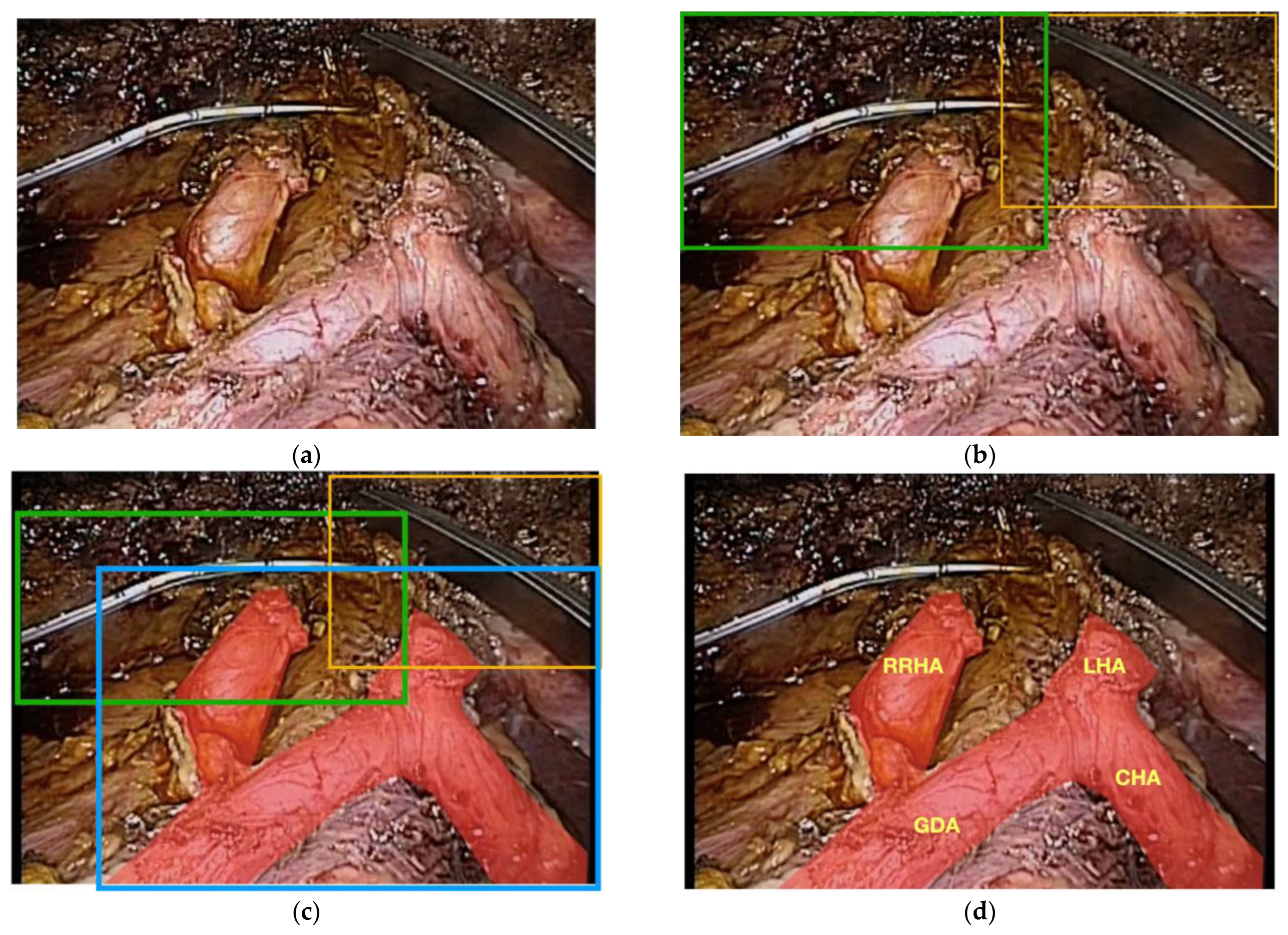 Sensors 22 04918 g005