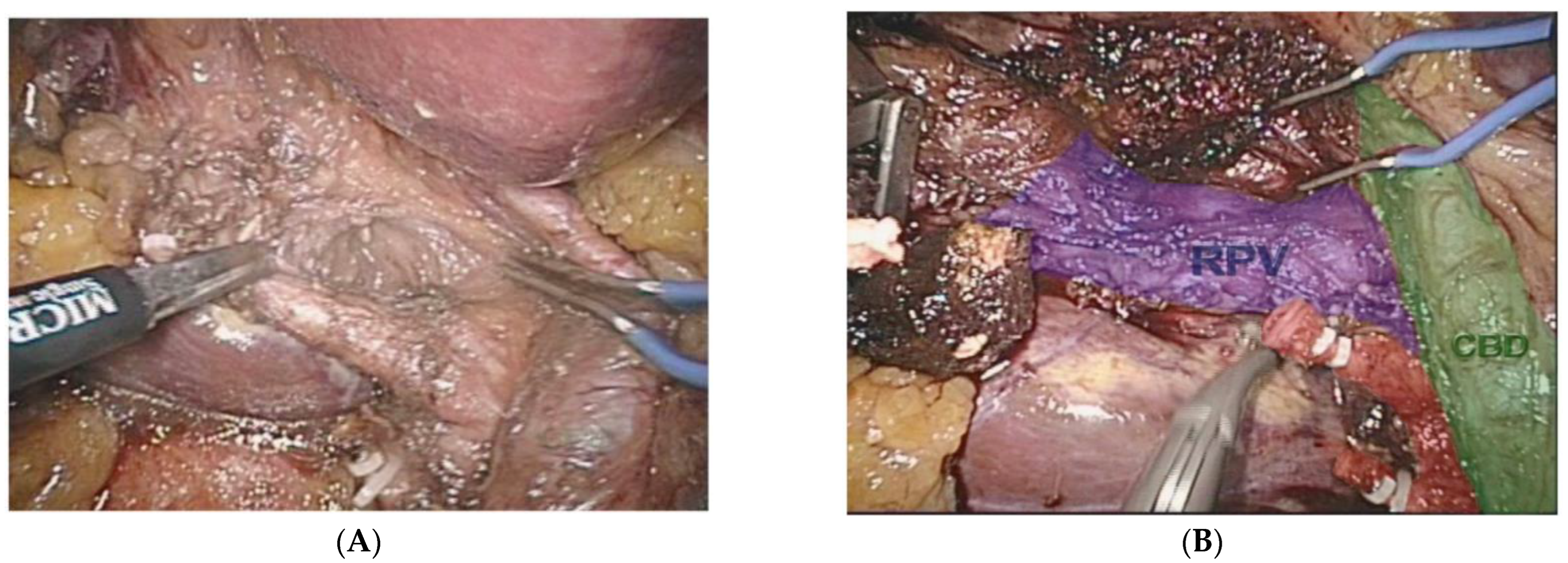 Sensors 22 04918 g006