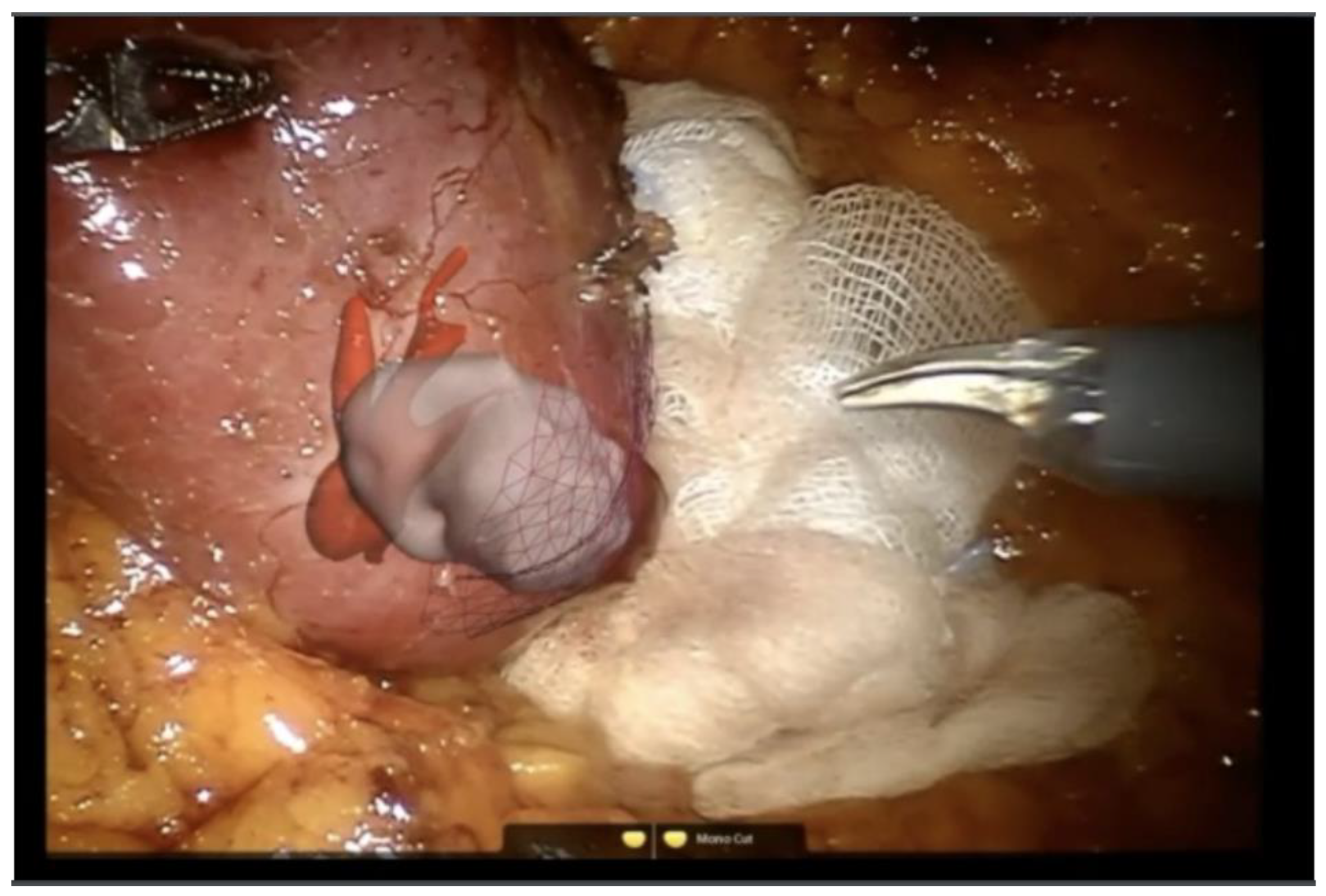 Sensors 22 04918 g008