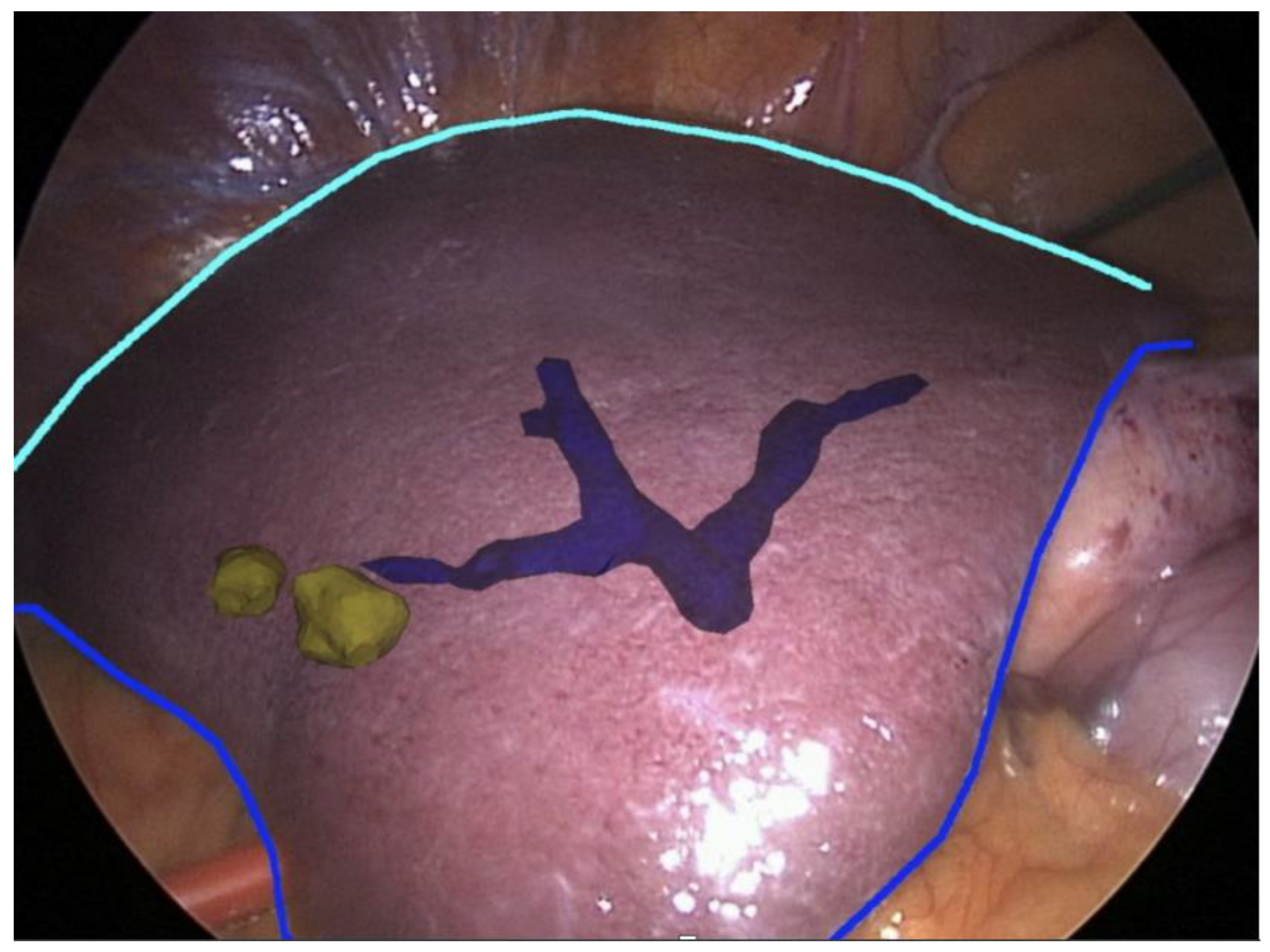 Sensors 22 04918 g009