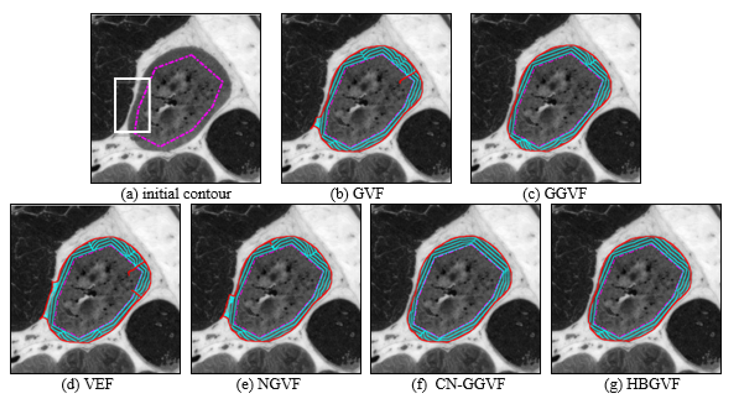 Sensors 22 04956 g006