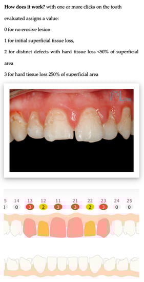 Sensors 22 05133 g002 550
